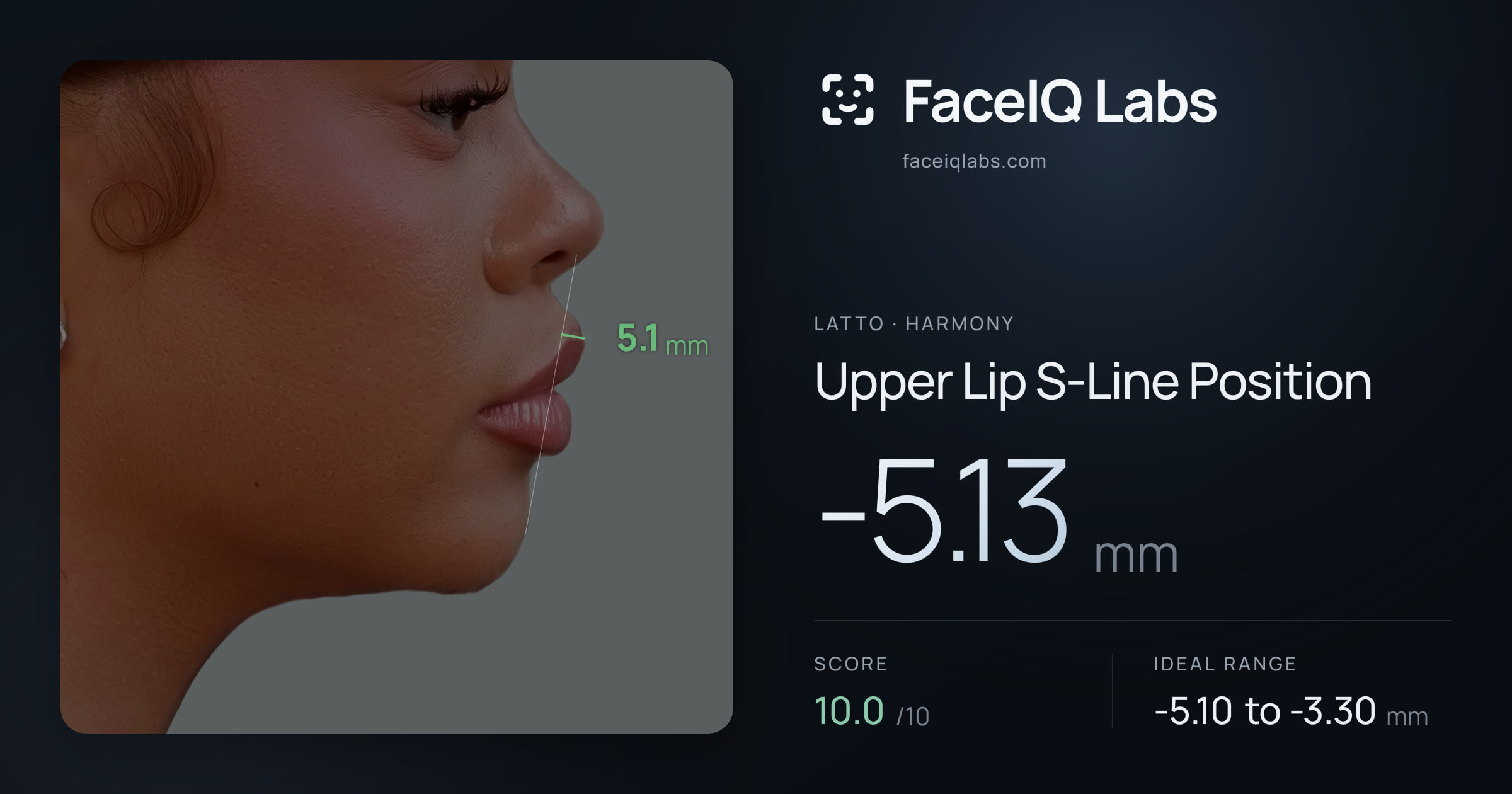 Latto Upper Lip S-Line Position: -5.13mm, drawn on the photo