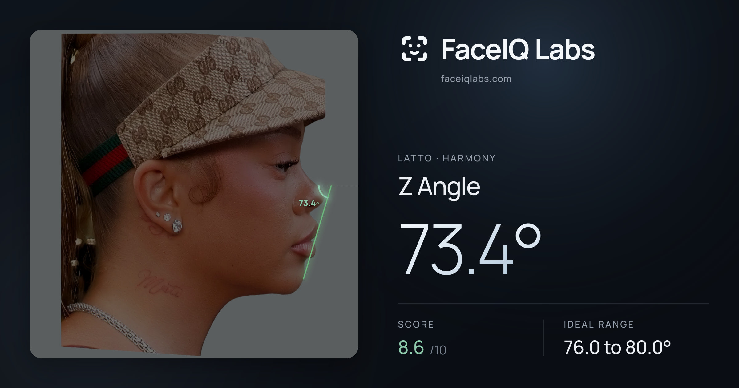 Latto Z Angle: 73.4°, drawn on the photo