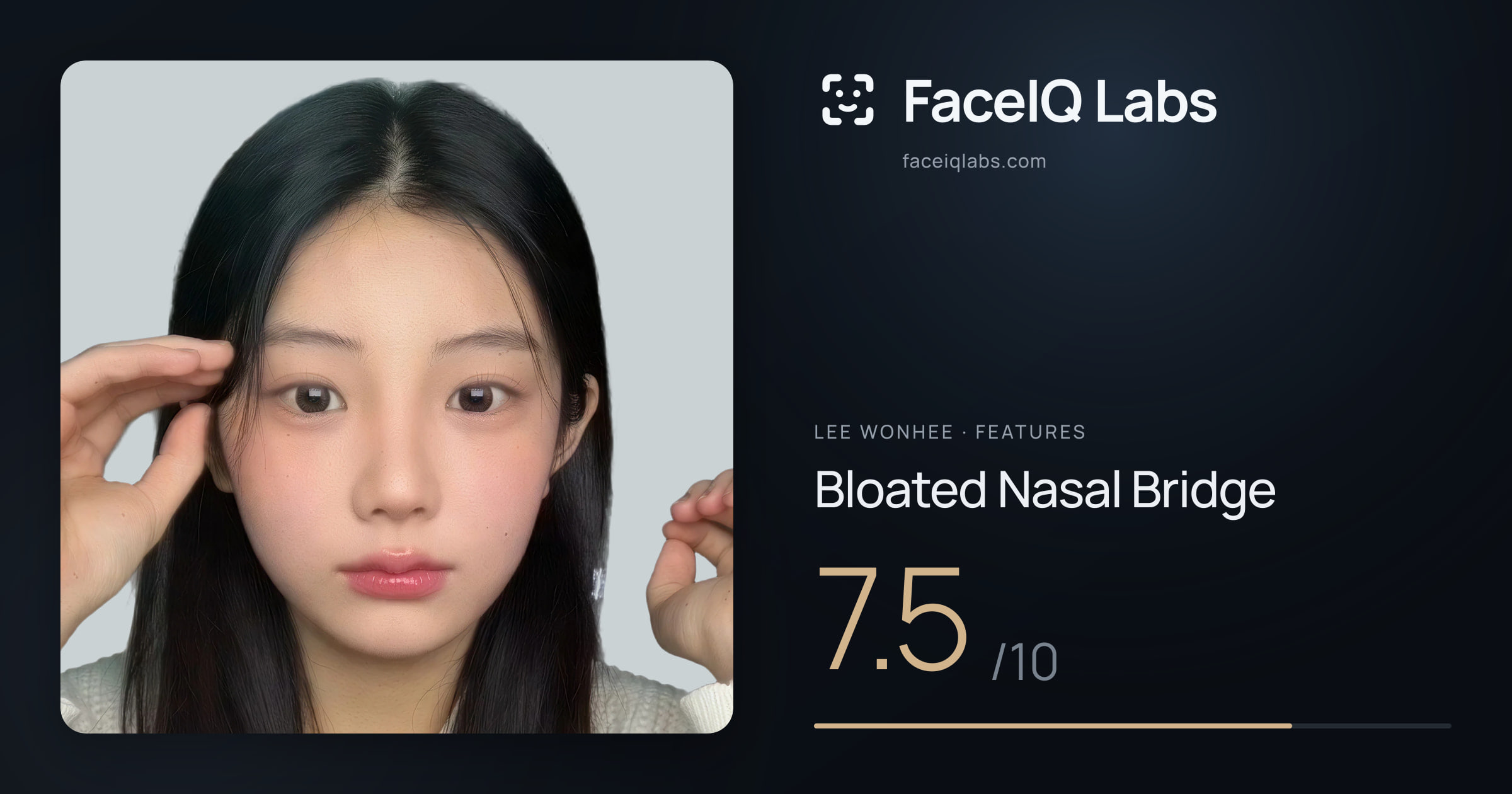 Lee Wonhee Bloated Nasal Bridge: 7.5/10, drawn on the photo