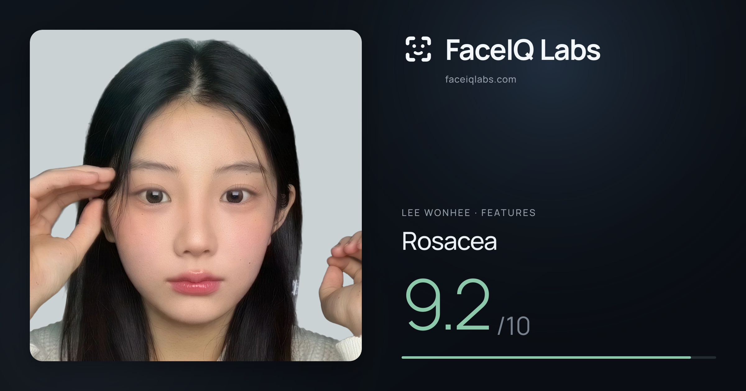 Lee Wonhee Rosacea: 9.2/10, drawn on the photo