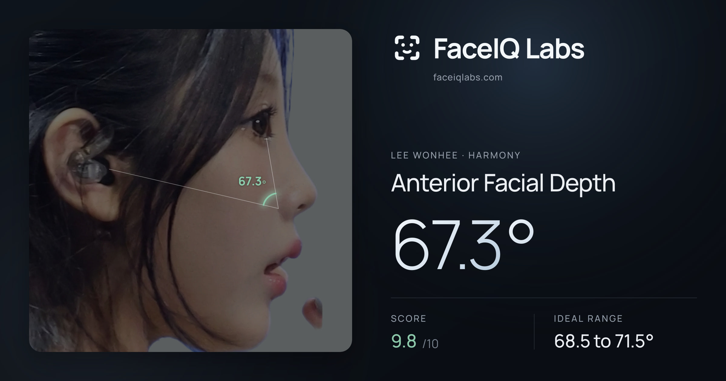 Lee Wonhee Anterior Facial Depth: 67.3°, drawn on the photo