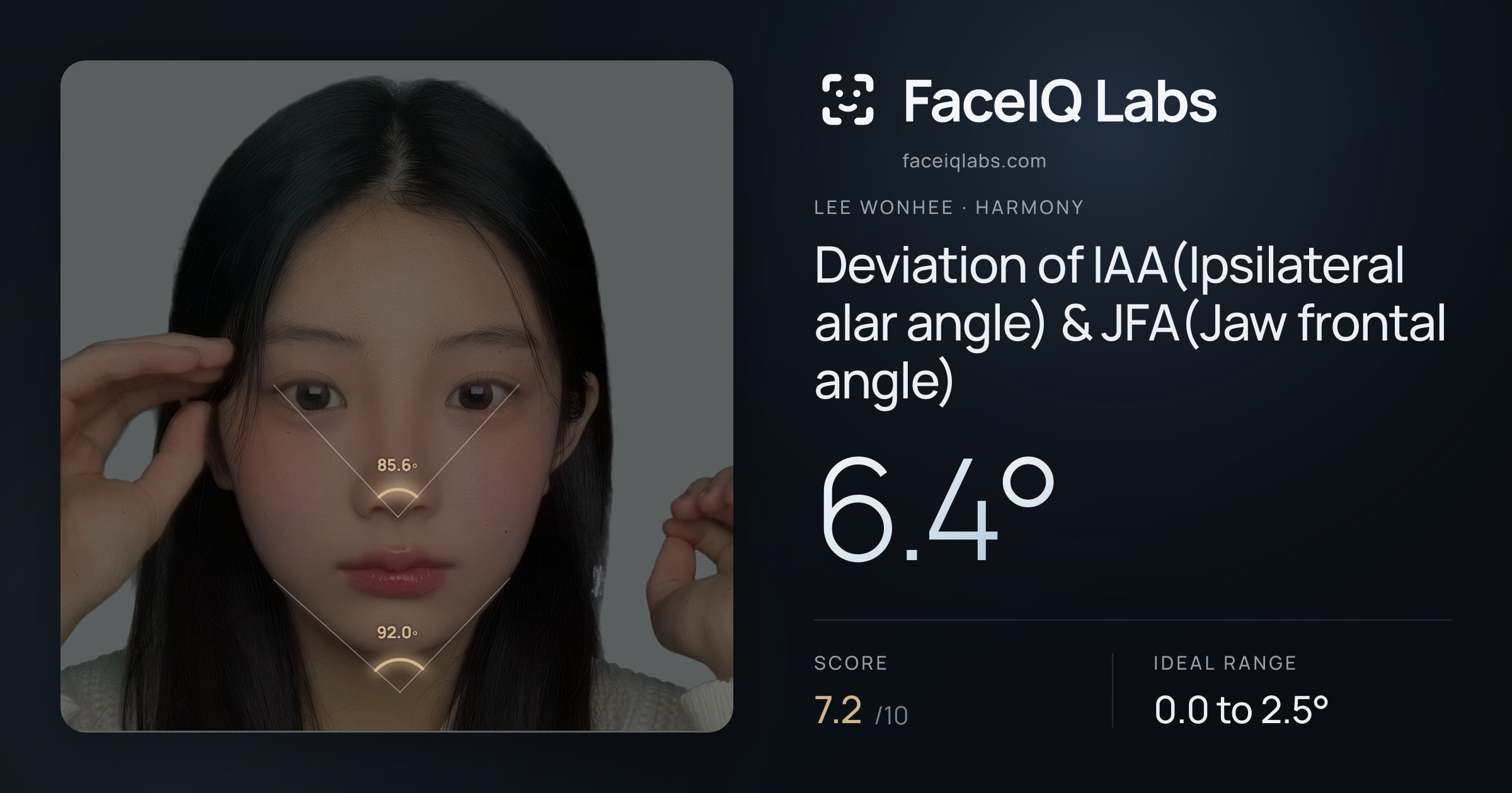 Lee Wonhee Deviation of IAA(Ipsilateral alar angle) & JFA(Jaw frontal angle): 6.4°, drawn on the photo