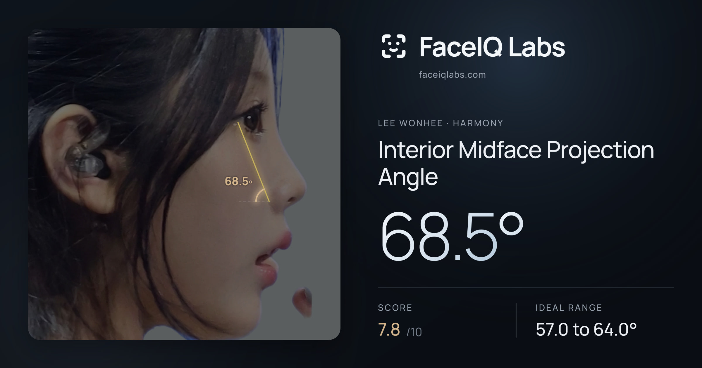 Lee Wonhee Interior Midface Projection Angle: 68.5°, drawn on the photo