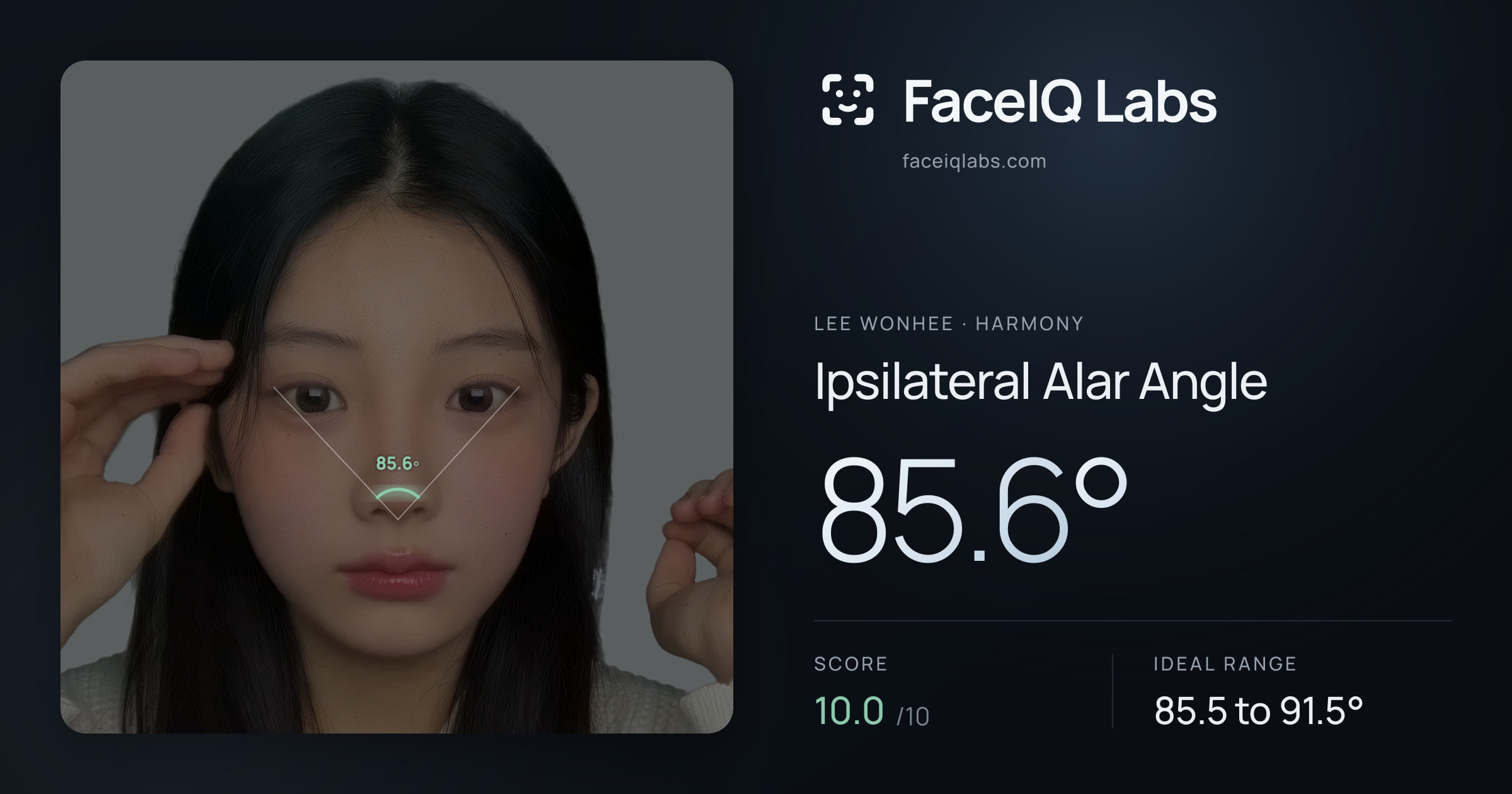 Lee Wonhee Ipsilateral Alar Angle: 85.6°, drawn on the photo