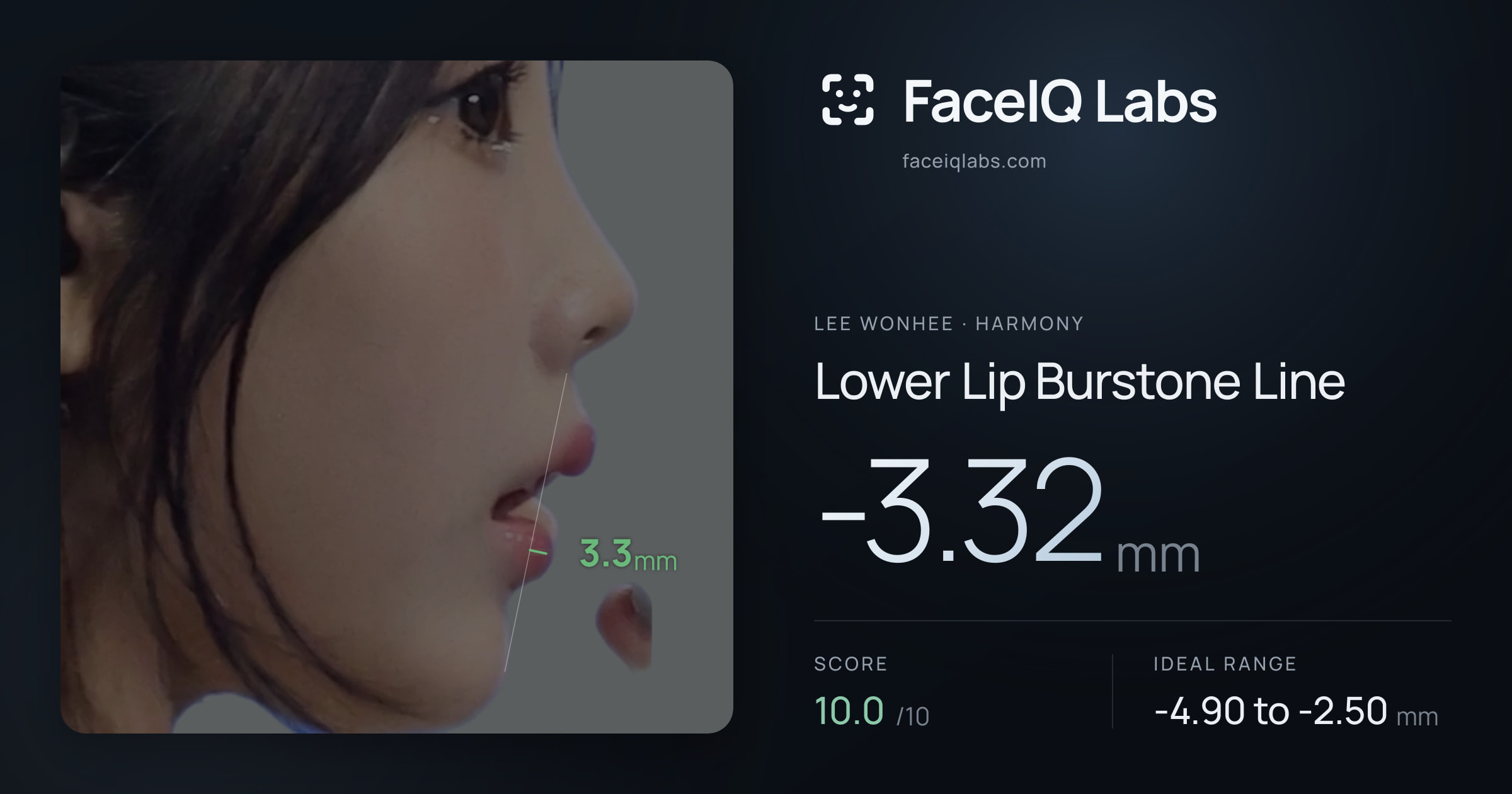 Lee Wonhee Lower Lip Burstone Line: -3.32mm, drawn on the photo