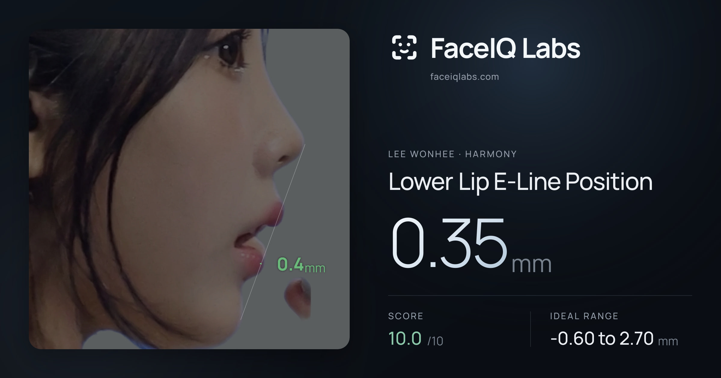 Lee Wonhee Lower Lip E-Line Position: 0.35mm, drawn on the photo