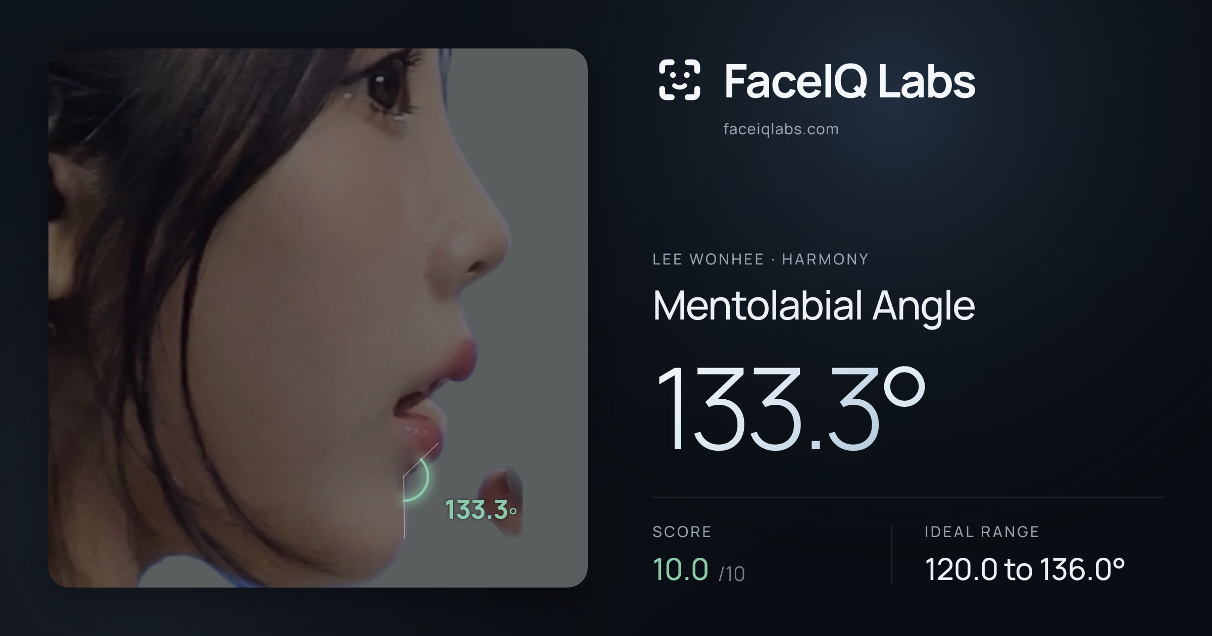 Lee Wonhee Mentolabial Angle: 133.3°, drawn on the photo