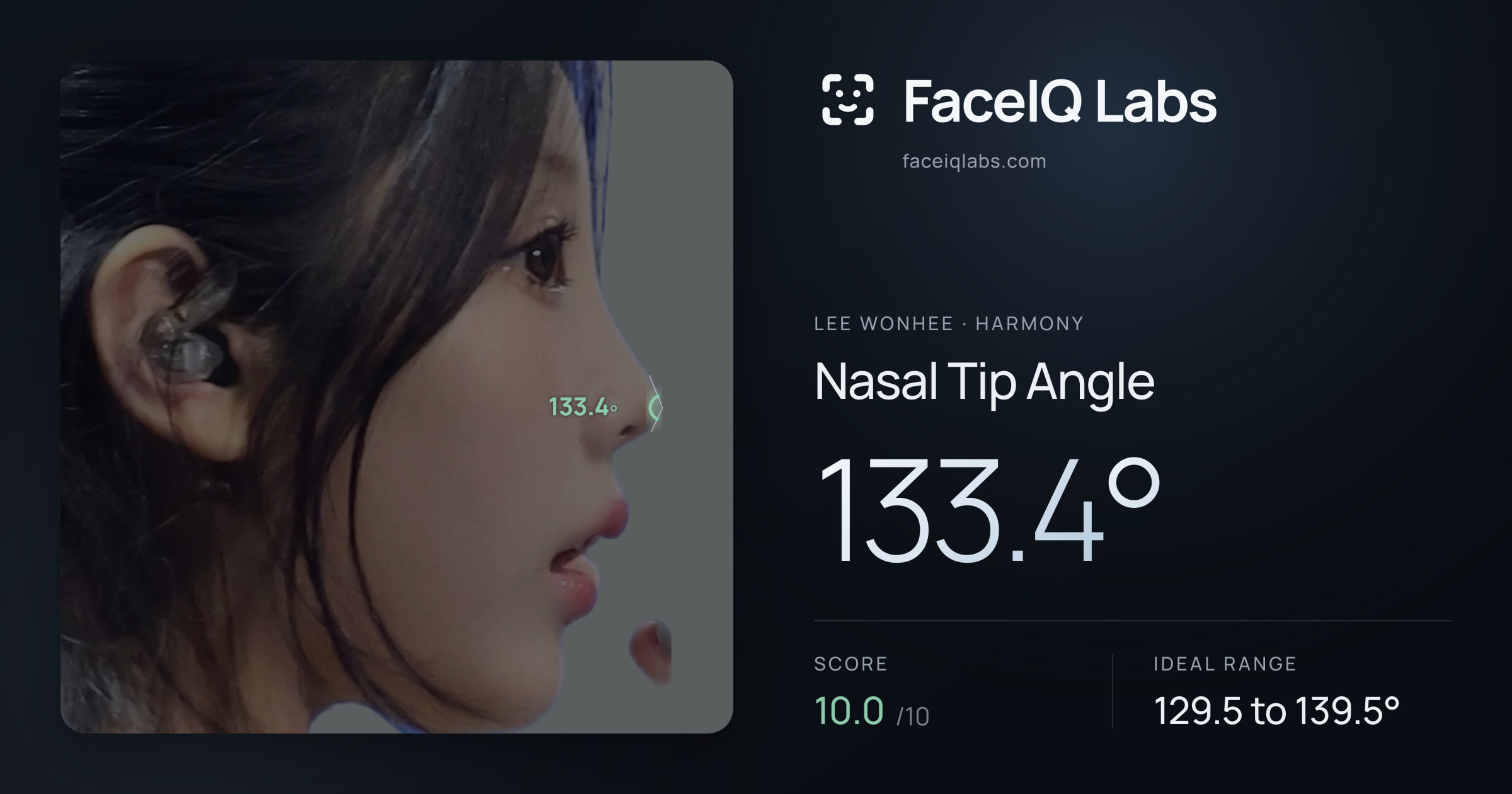Lee Wonhee Nasal Tip Angle: 133.4°, drawn on the photo