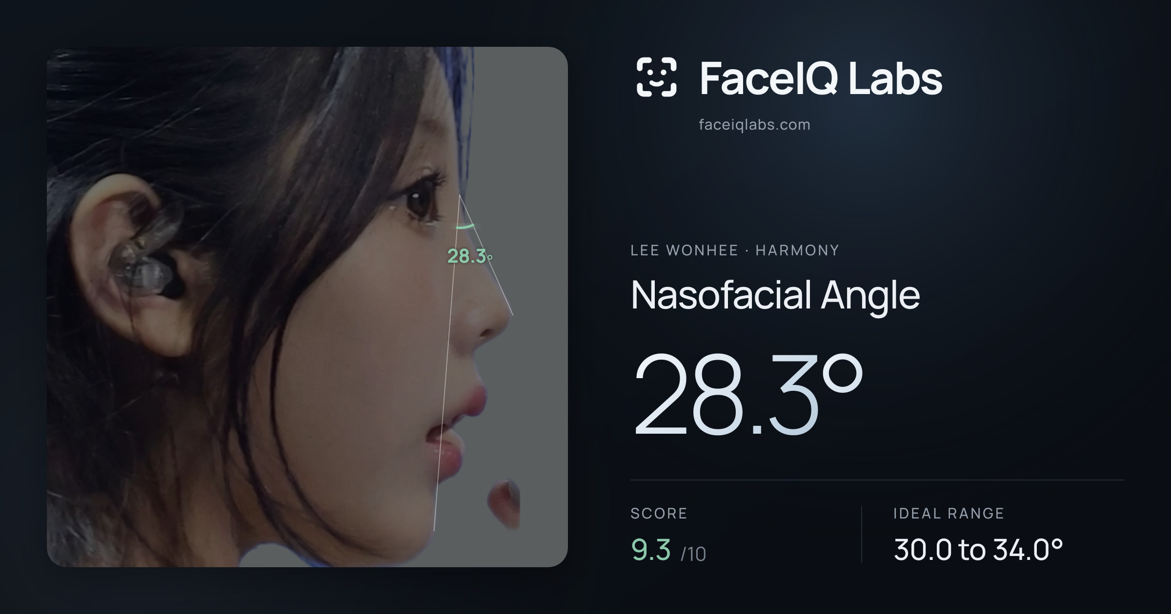 Lee Wonhee Nasofacial Angle: 28.3°, drawn on the photo