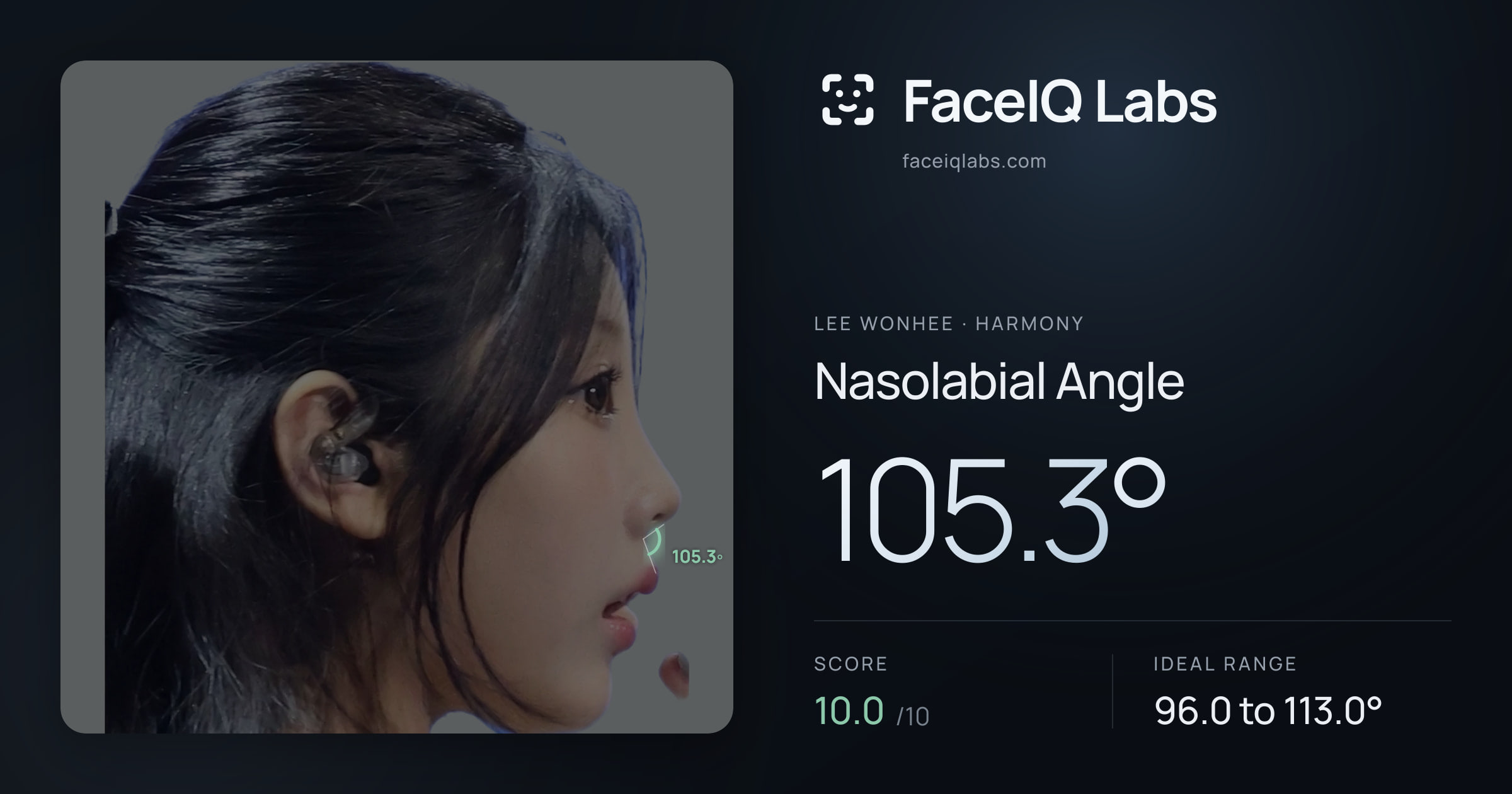 Lee Wonhee Nasolabial Angle: 105.3°, drawn on the photo