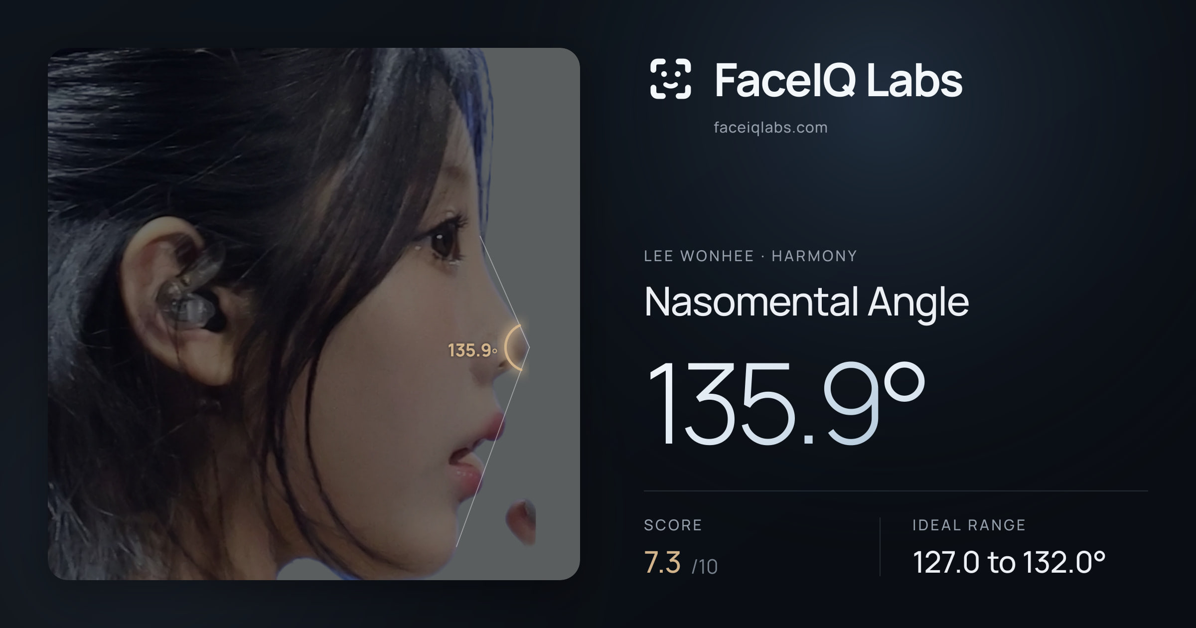 Lee Wonhee Nasomental Angle: 135.9°, drawn on the photo