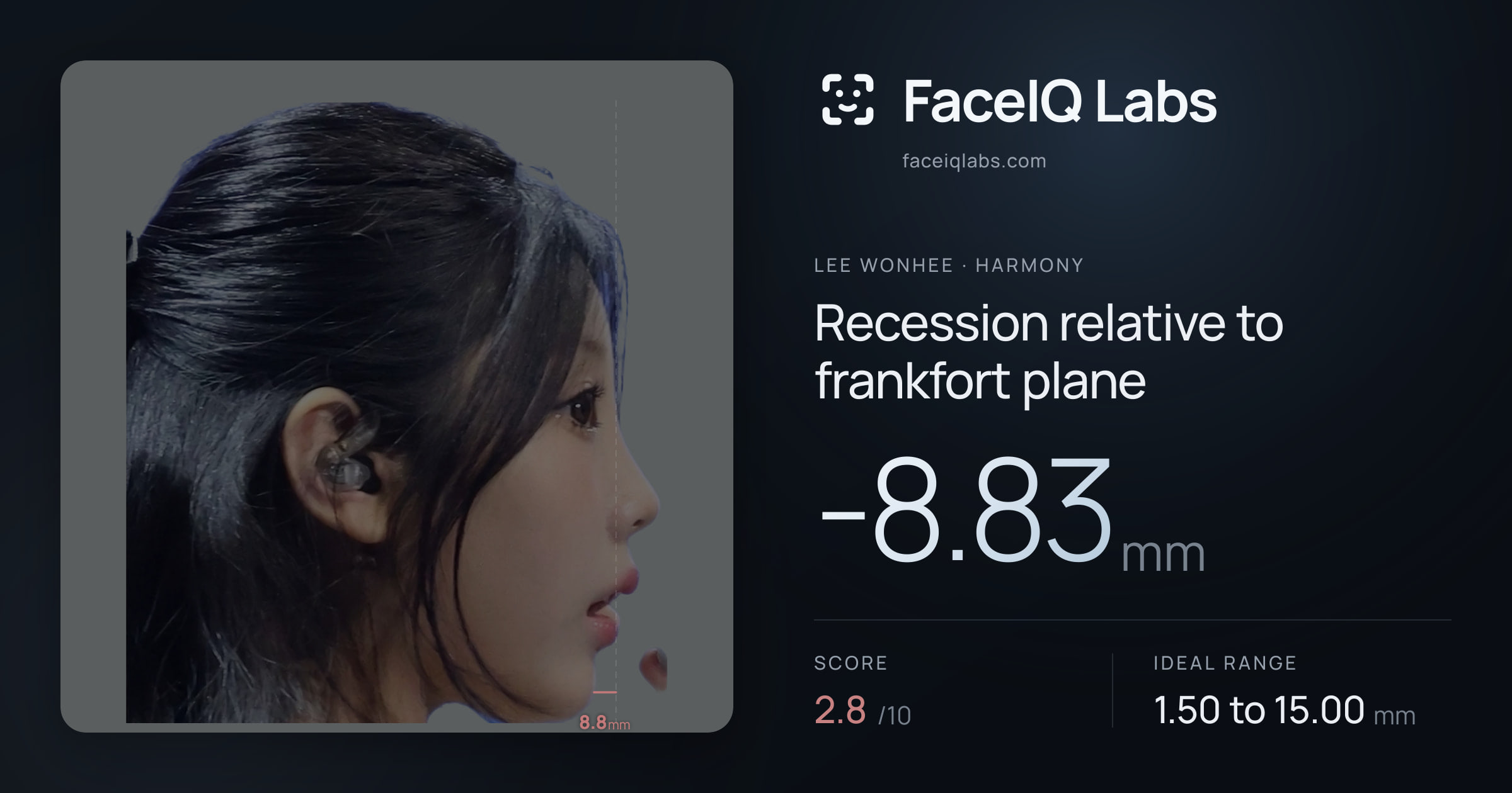 Lee Wonhee Recession relative to frankfort plane: -8.83mm, drawn on the photo