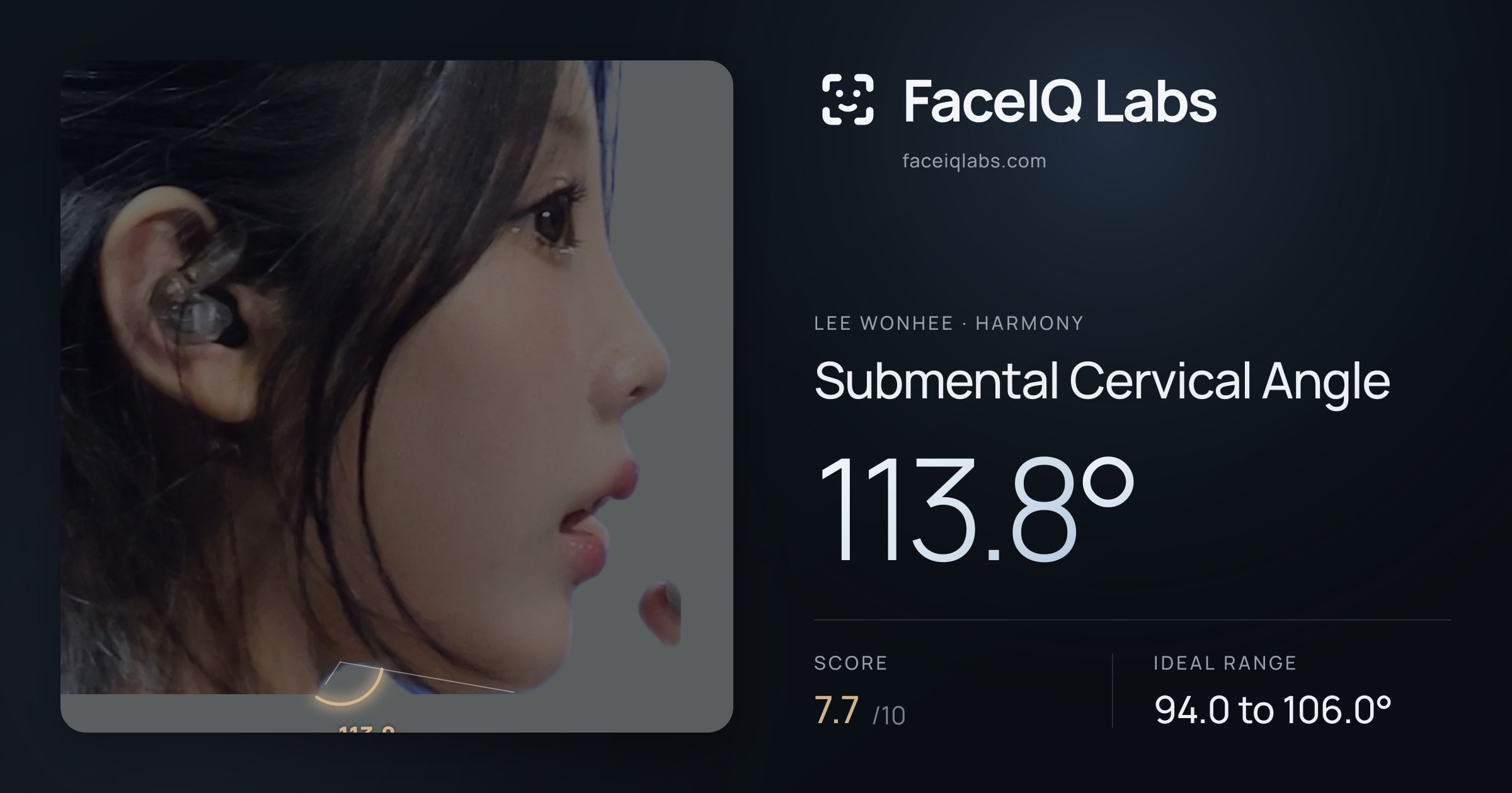 Lee Wonhee Submental Cervical Angle: 113.8°, drawn on the photo