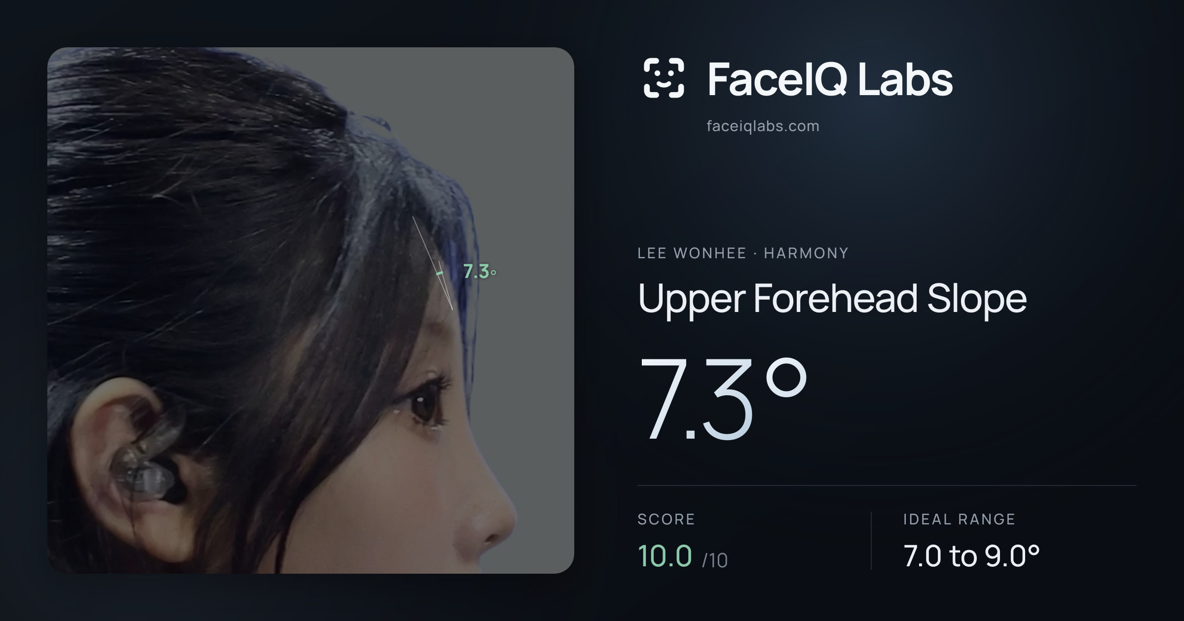 Lee Wonhee Upper Forehead Slope: 7.3°, drawn on the photo