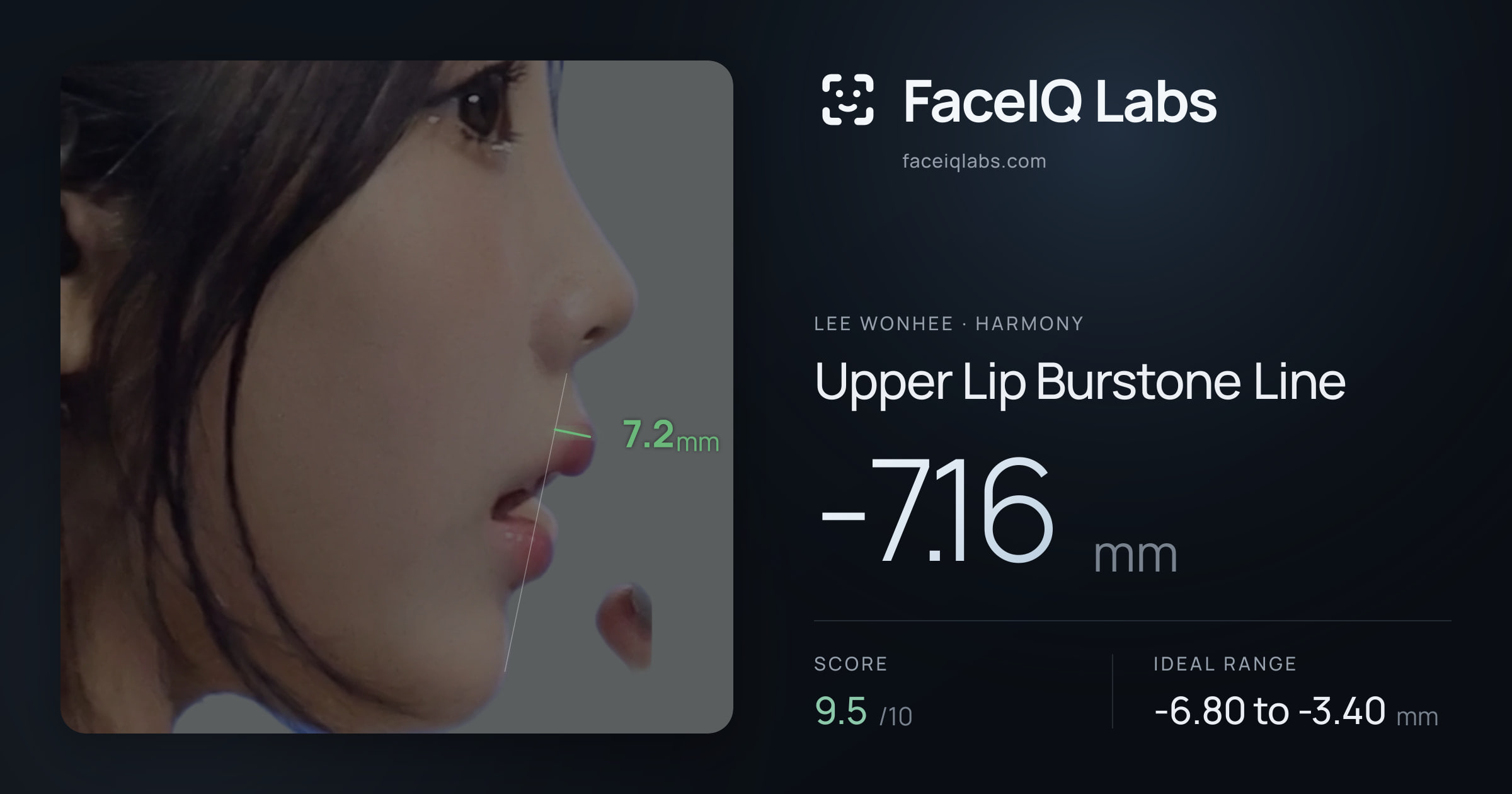 Lee Wonhee Upper Lip Burstone Line: -7.16mm, drawn on the photo