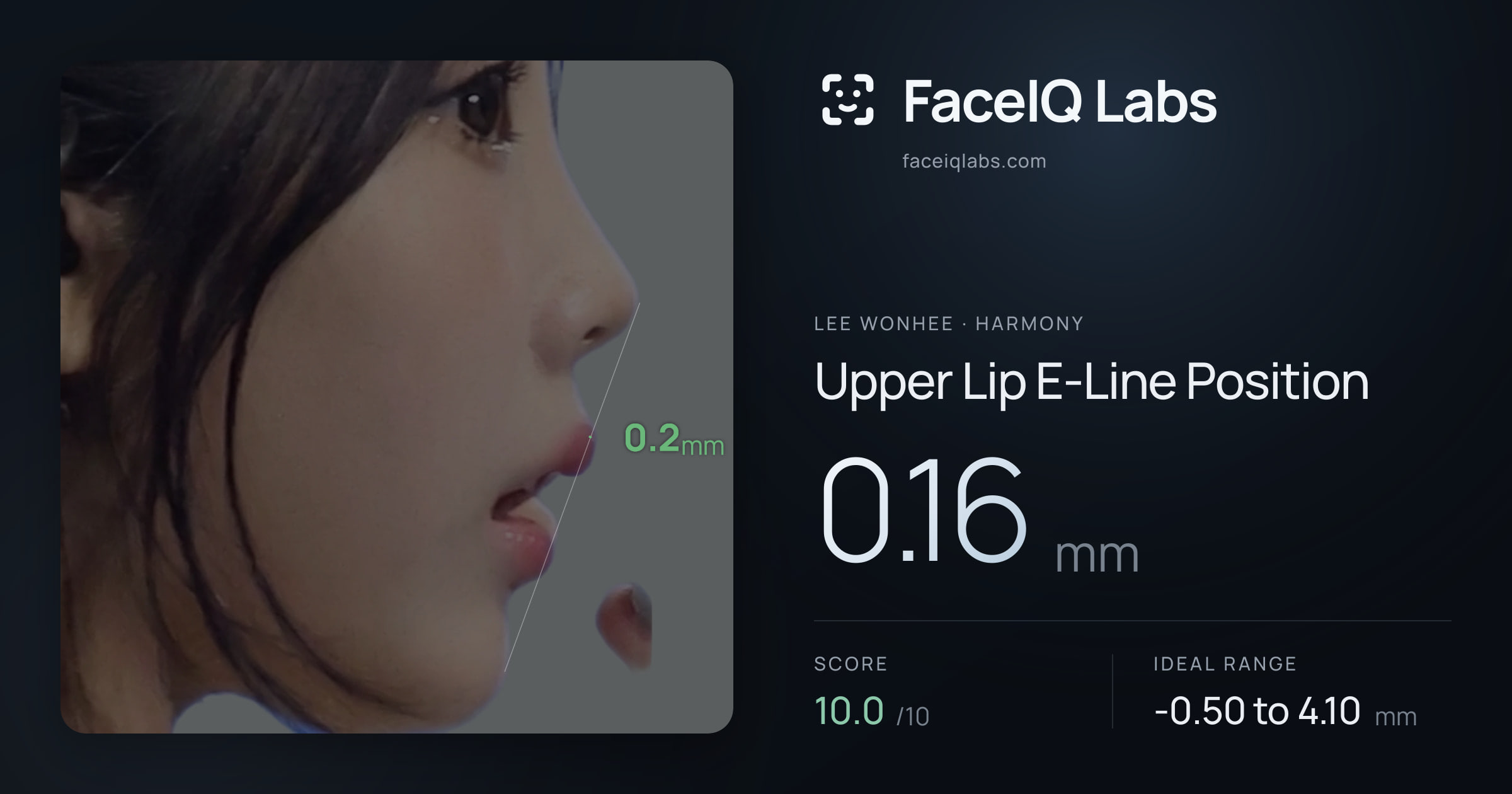 Lee Wonhee Upper Lip E-Line Position: 0.16mm, drawn on the photo