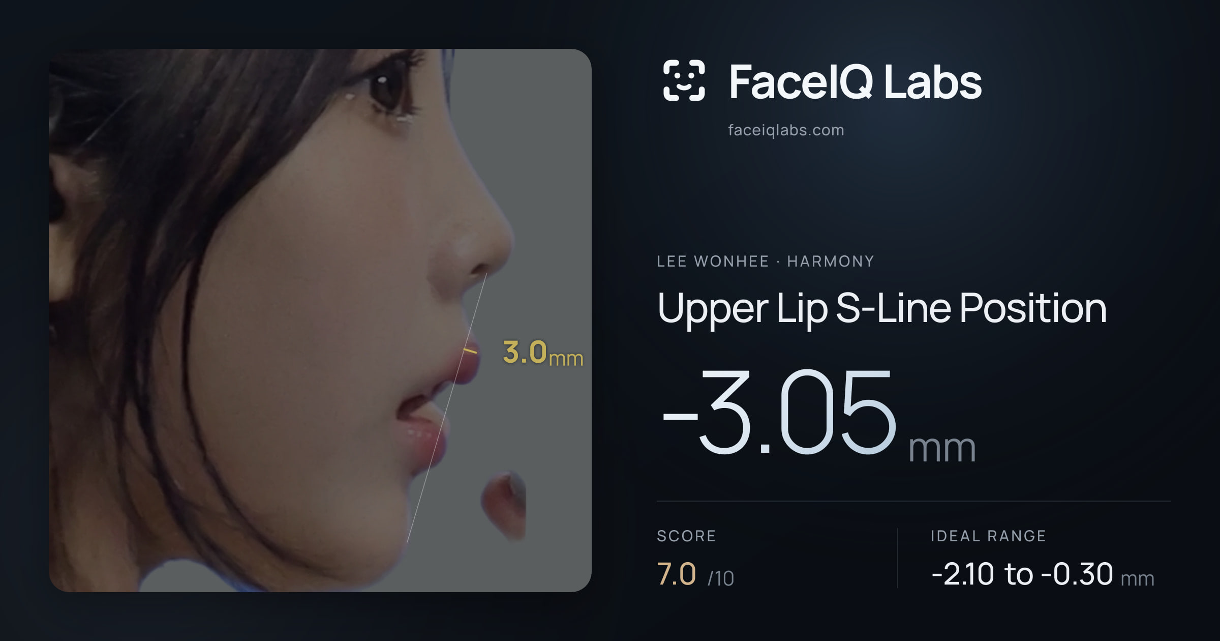 Lee Wonhee Upper Lip S-Line Position: -3.05mm, drawn on the photo