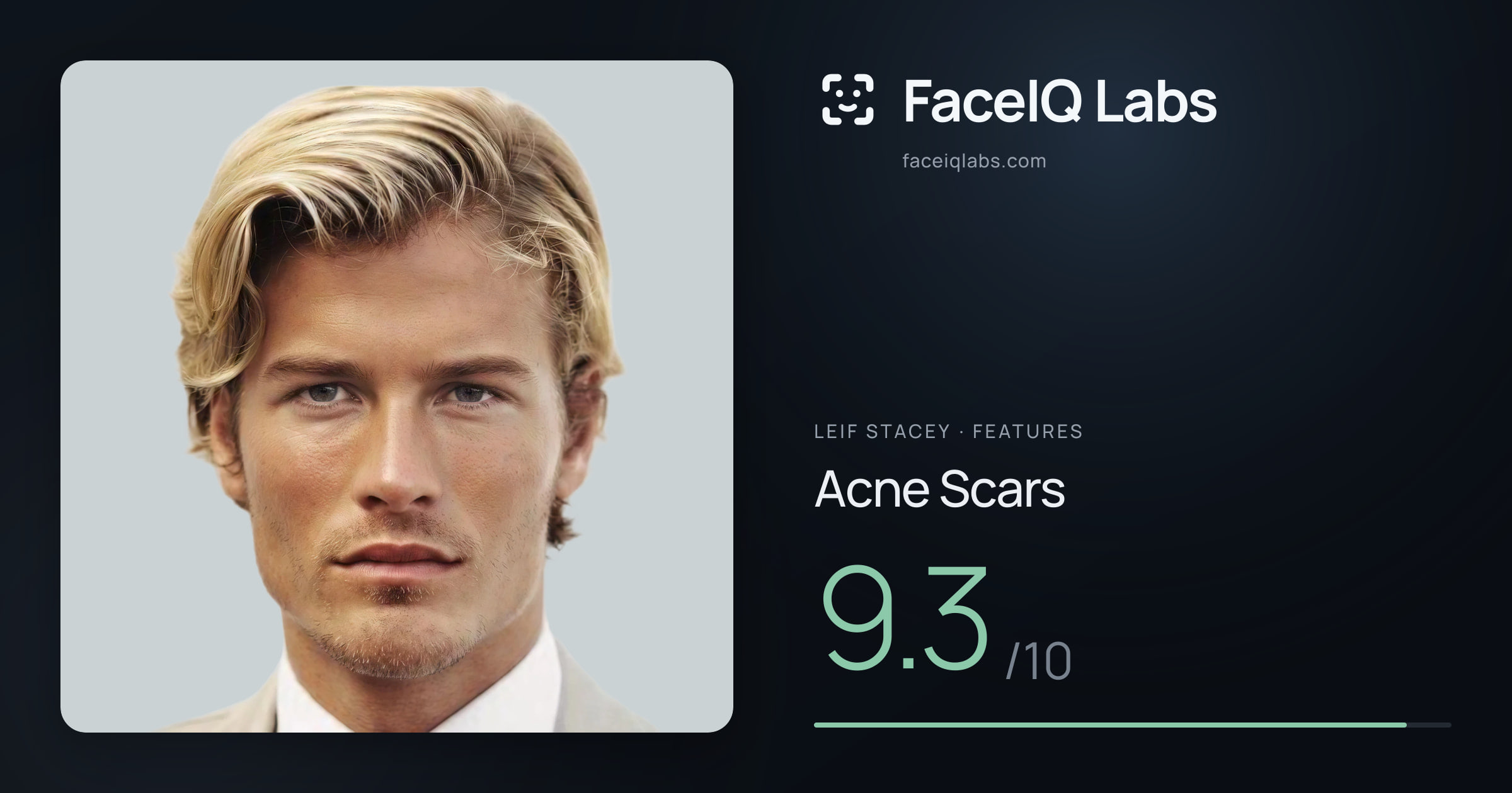 Leif Stacey Acne Scars: 9.3/10, drawn on the photo