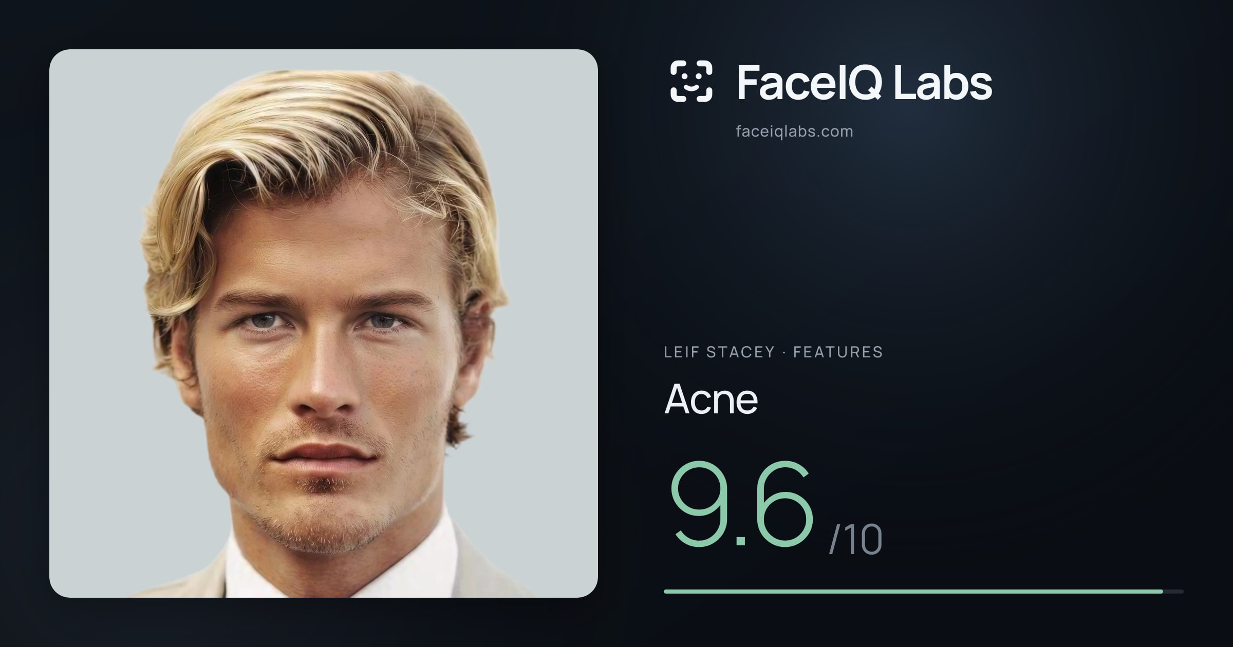 Leif Stacey Acne: 9.6/10, drawn on the photo