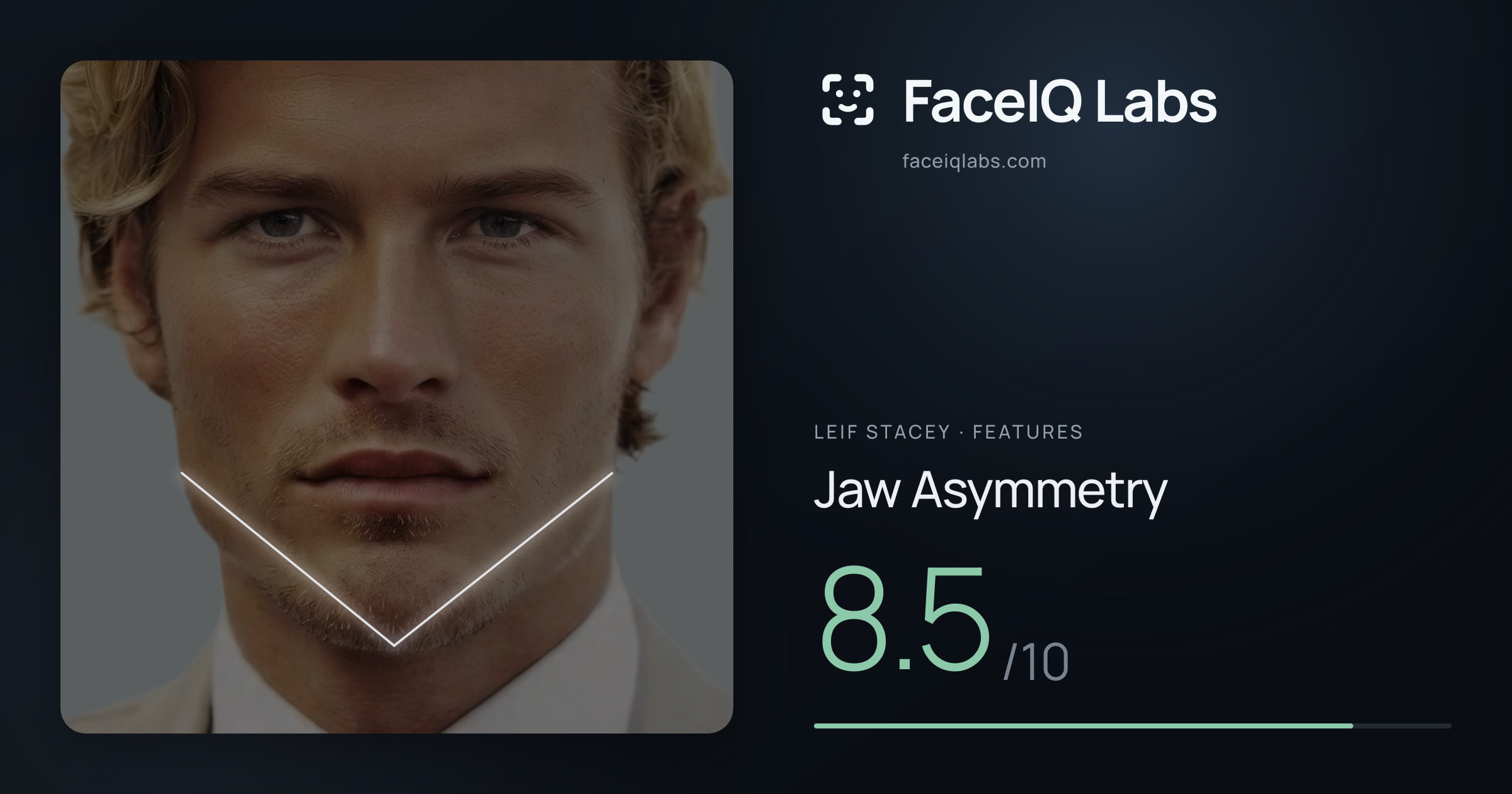 Leif Stacey Jaw Asymmetry: 8.5/10, drawn on the photo