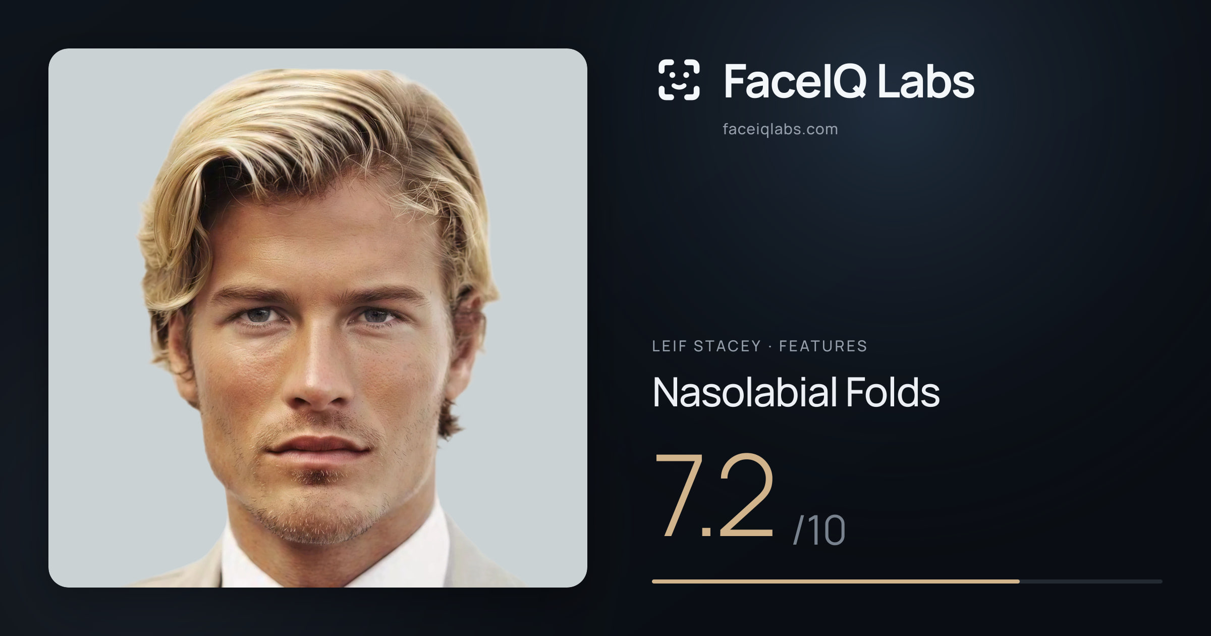 Leif Stacey Nasolabial Folds: 7.2/10, drawn on the photo
