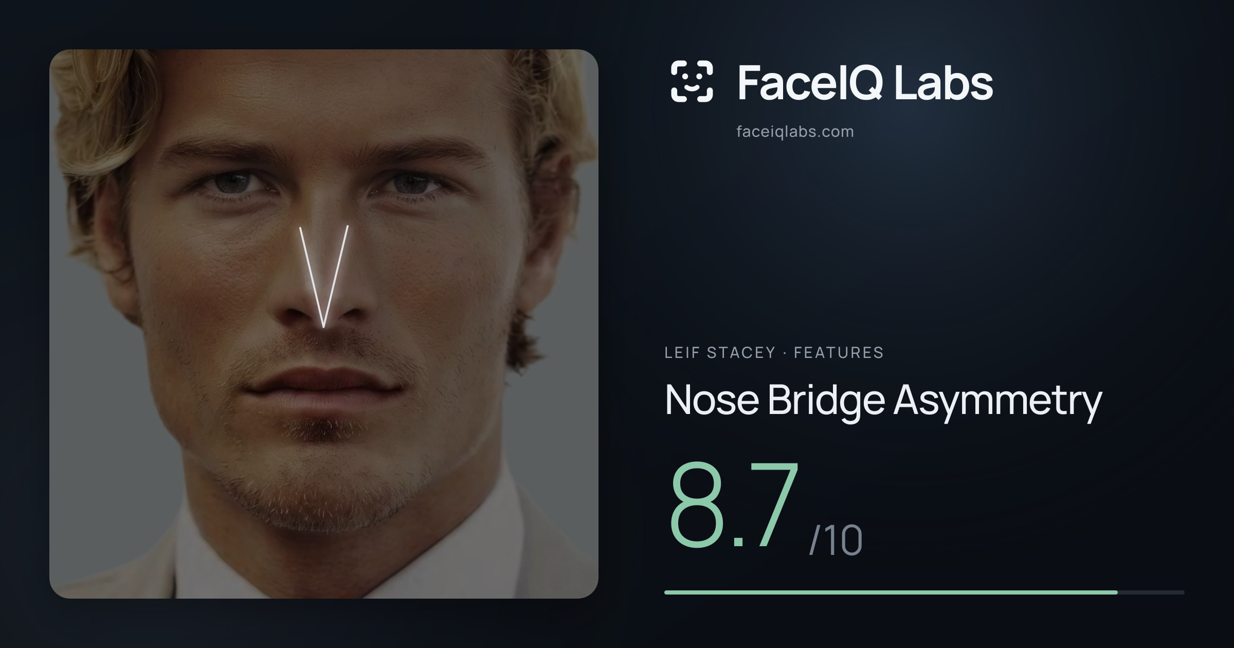 Leif Stacey Nose Bridge Asymmetry: 8.7/10, drawn on the photo