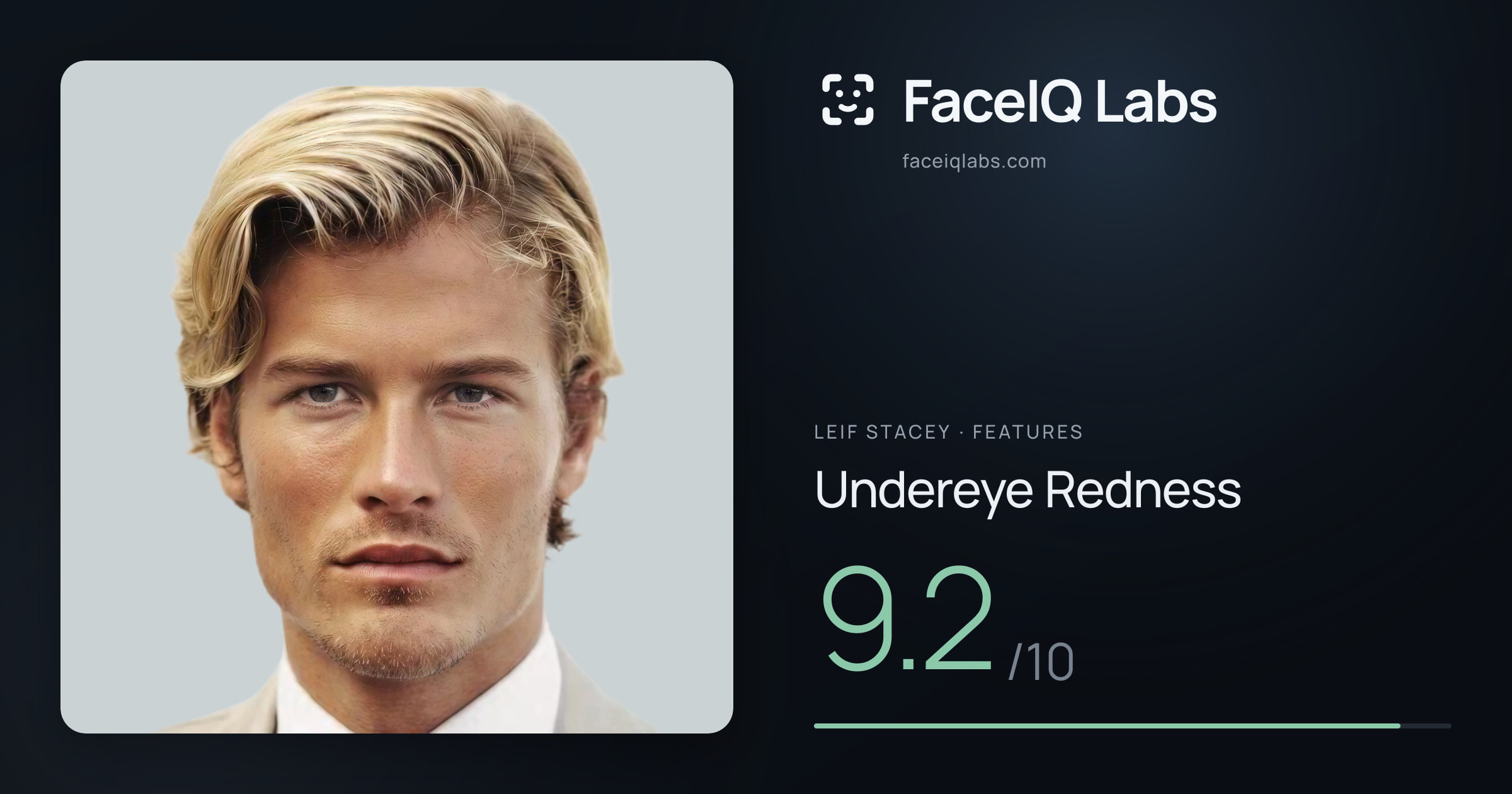 Leif Stacey Undereye Redness: 9.2/10, drawn on the photo