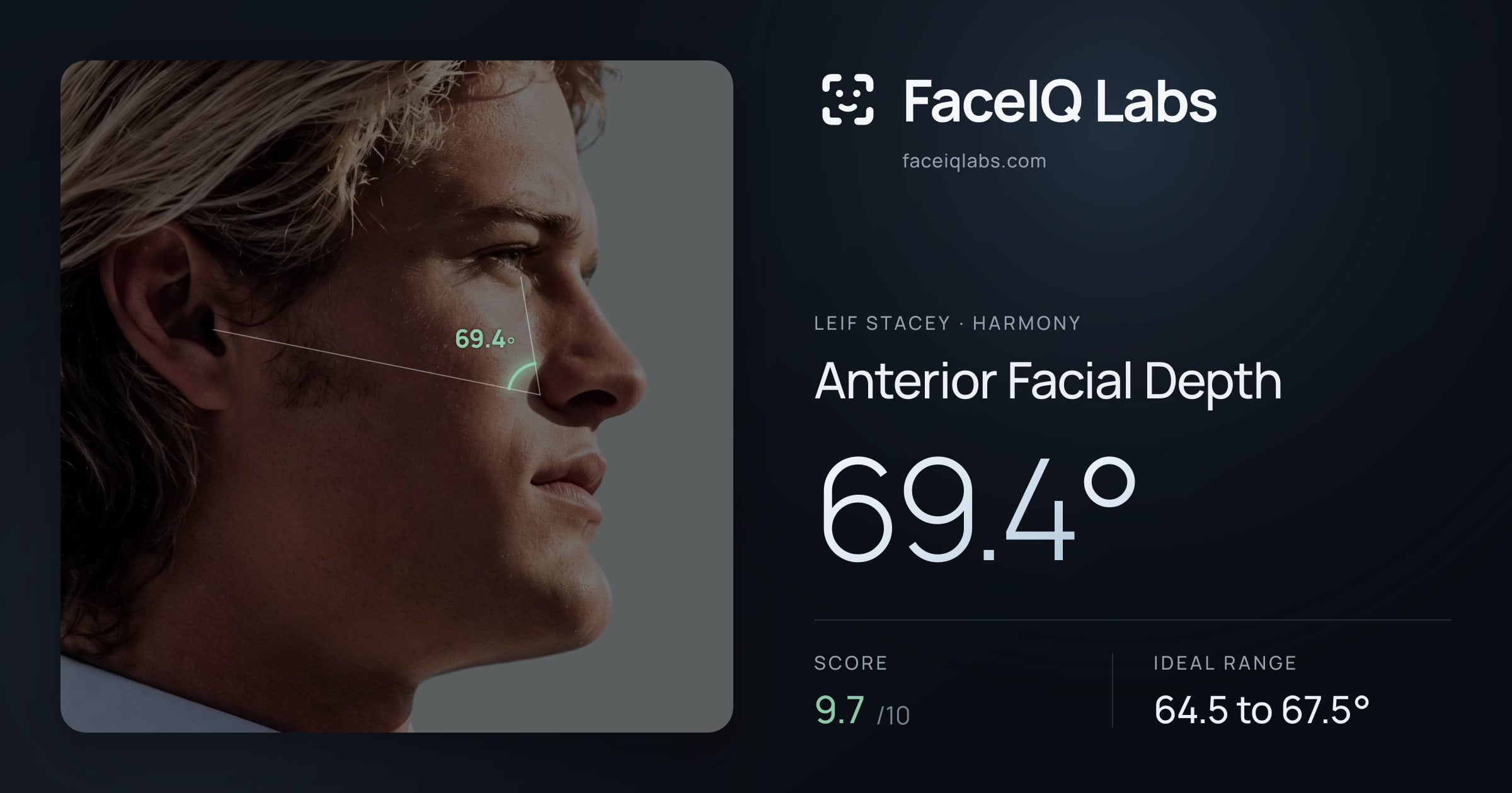 Leif Stacey Anterior Facial Depth: 69.4°, drawn on the photo