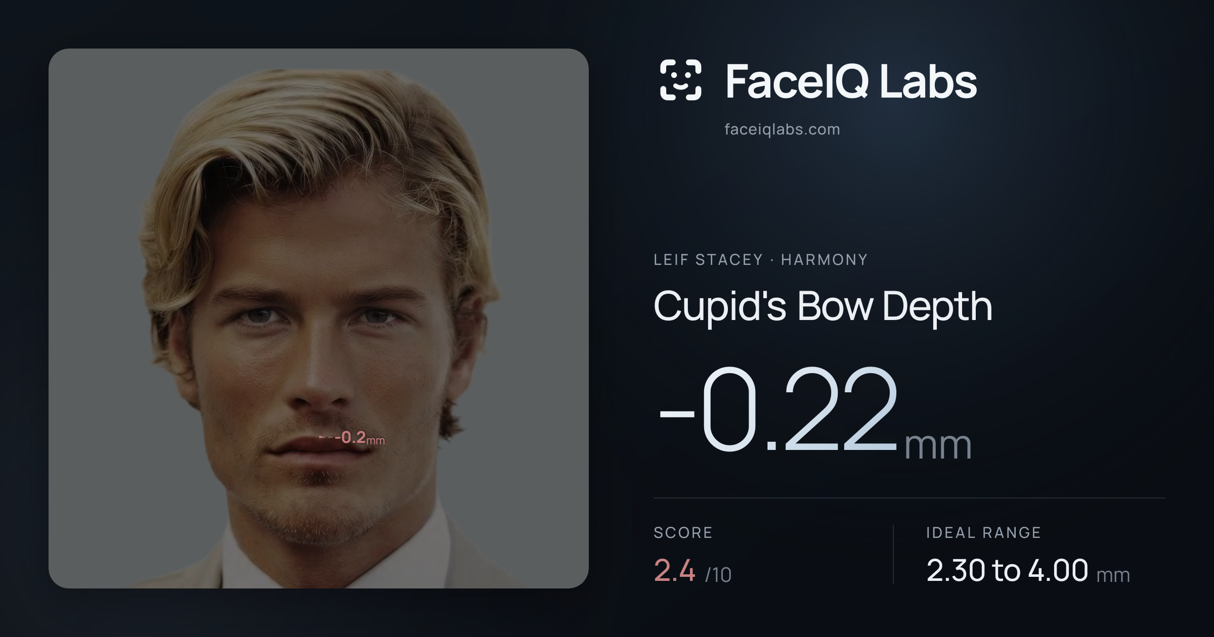 Leif Stacey Cupid's Bow Depth: -0.22mm, drawn on the photo