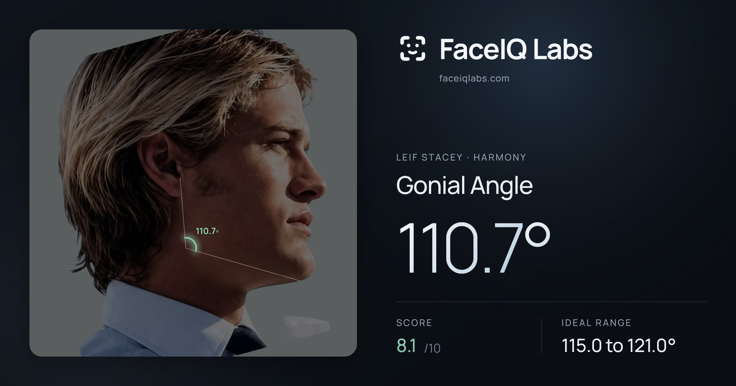 Leif Stacey Gonial Angle: 110.7°, drawn on the photo