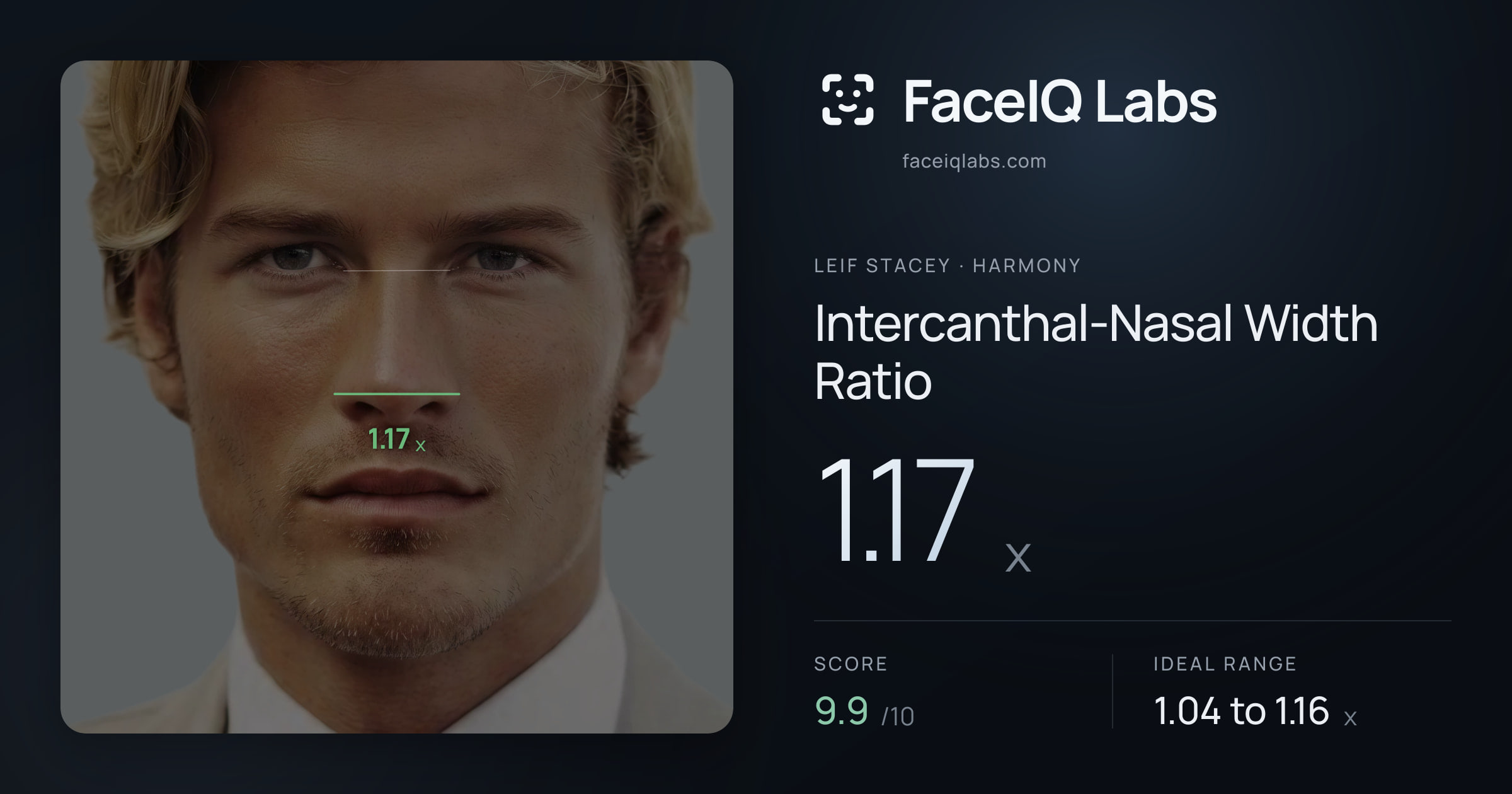 Leif Stacey Intercanthal-Nasal Width Ratio: 1.17x, drawn on the photo