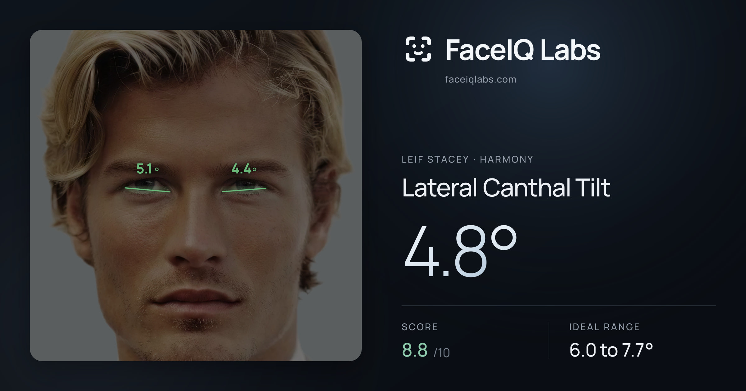 Leif Stacey Lateral Canthal Tilt: 4.8°, drawn on the photo