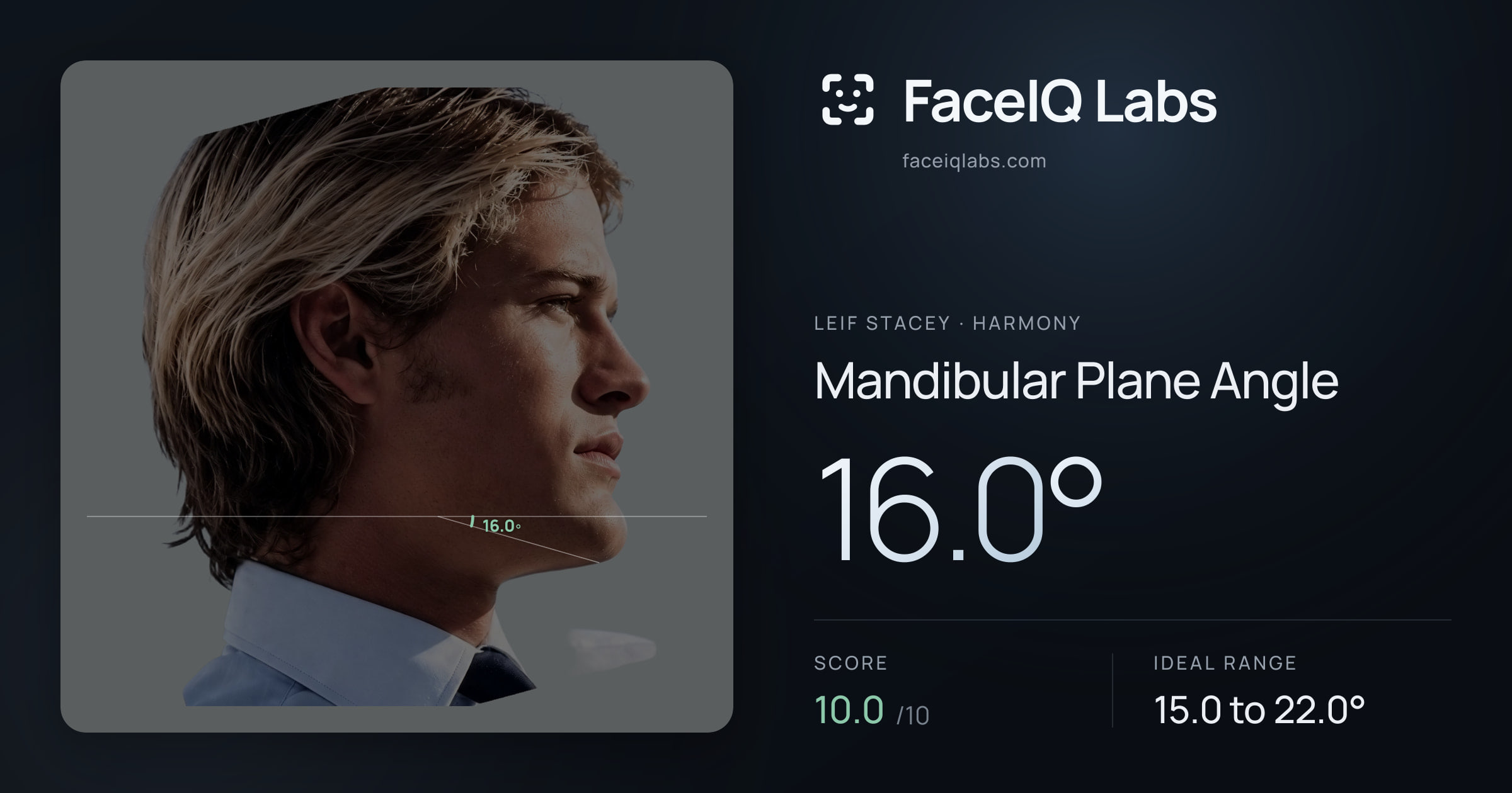 Leif Stacey Mandibular Plane Angle: 16.0°, drawn on the photo