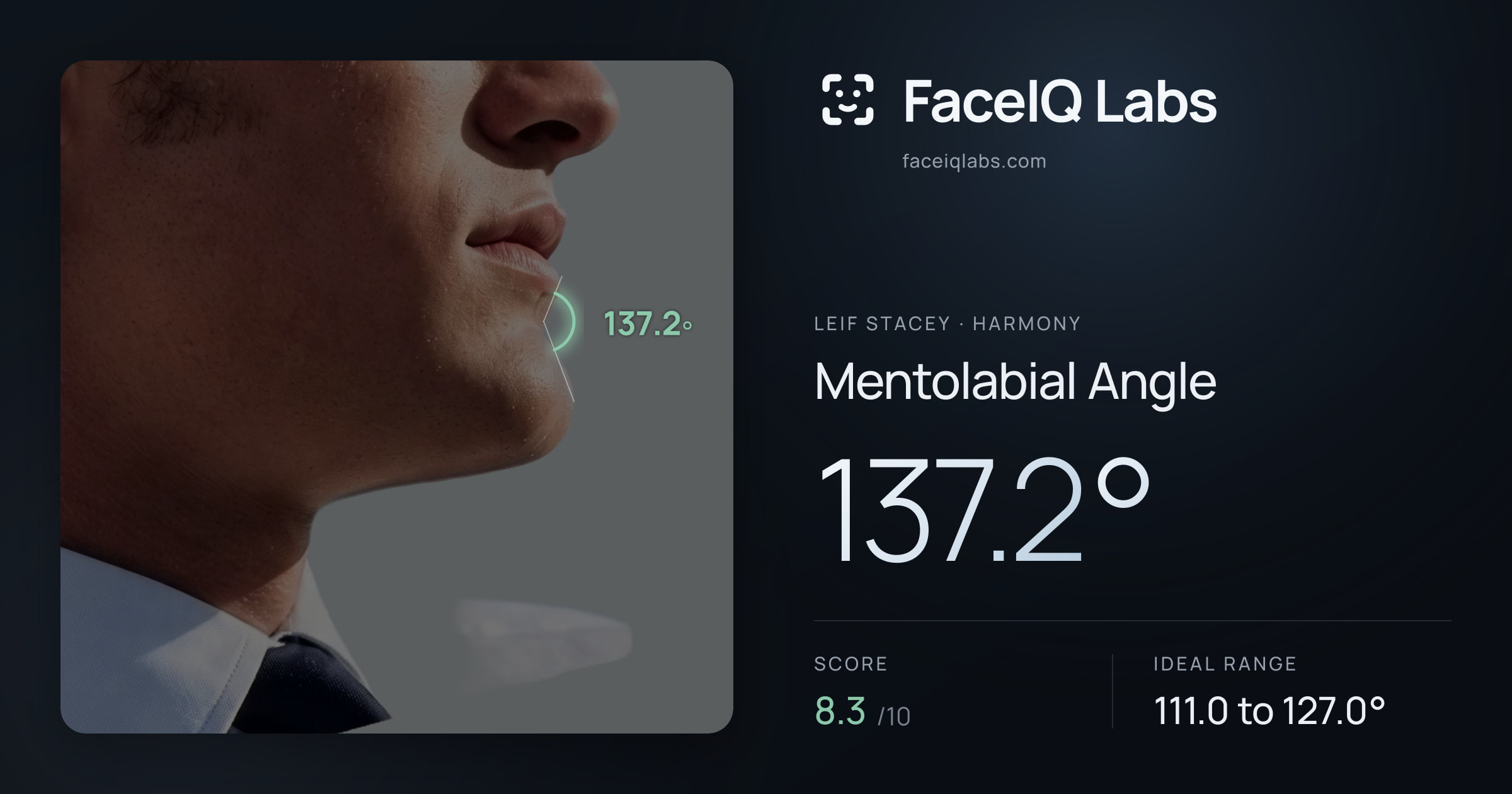 Leif Stacey Mentolabial Angle: 137.2°, drawn on the photo