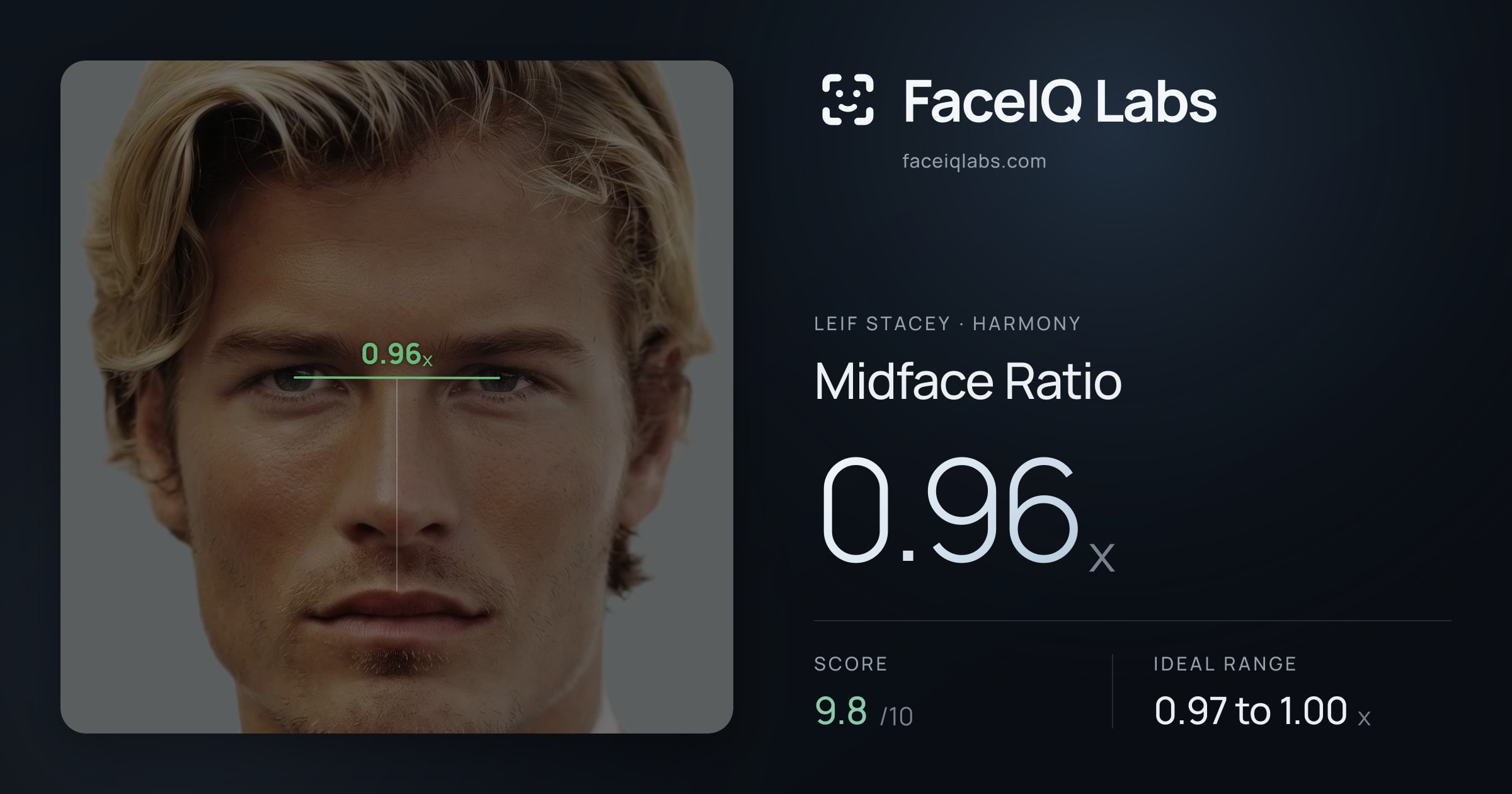 Leif Stacey Midface Ratio: 0.96x, drawn on the photo