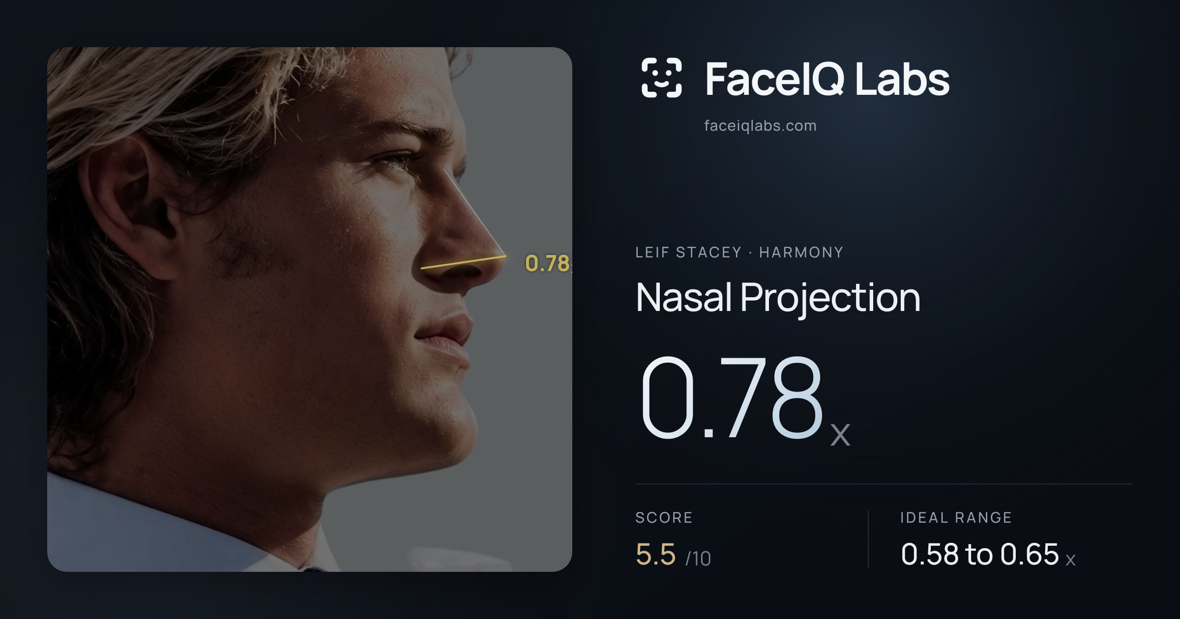 Leif Stacey Nasal Projection: 0.78x, drawn on the photo