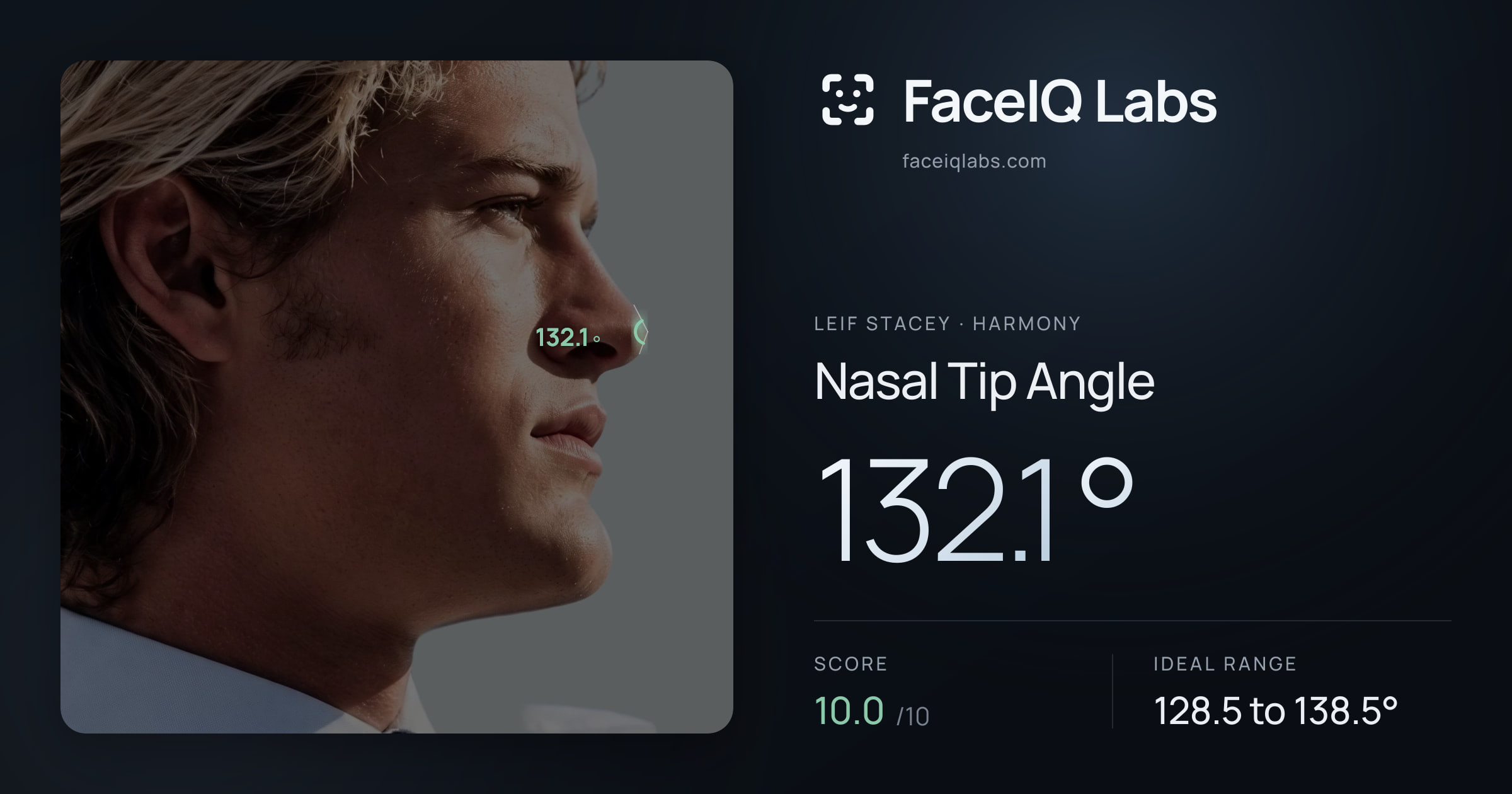 Leif Stacey Nasal Tip Angle: 132.1°, drawn on the photo