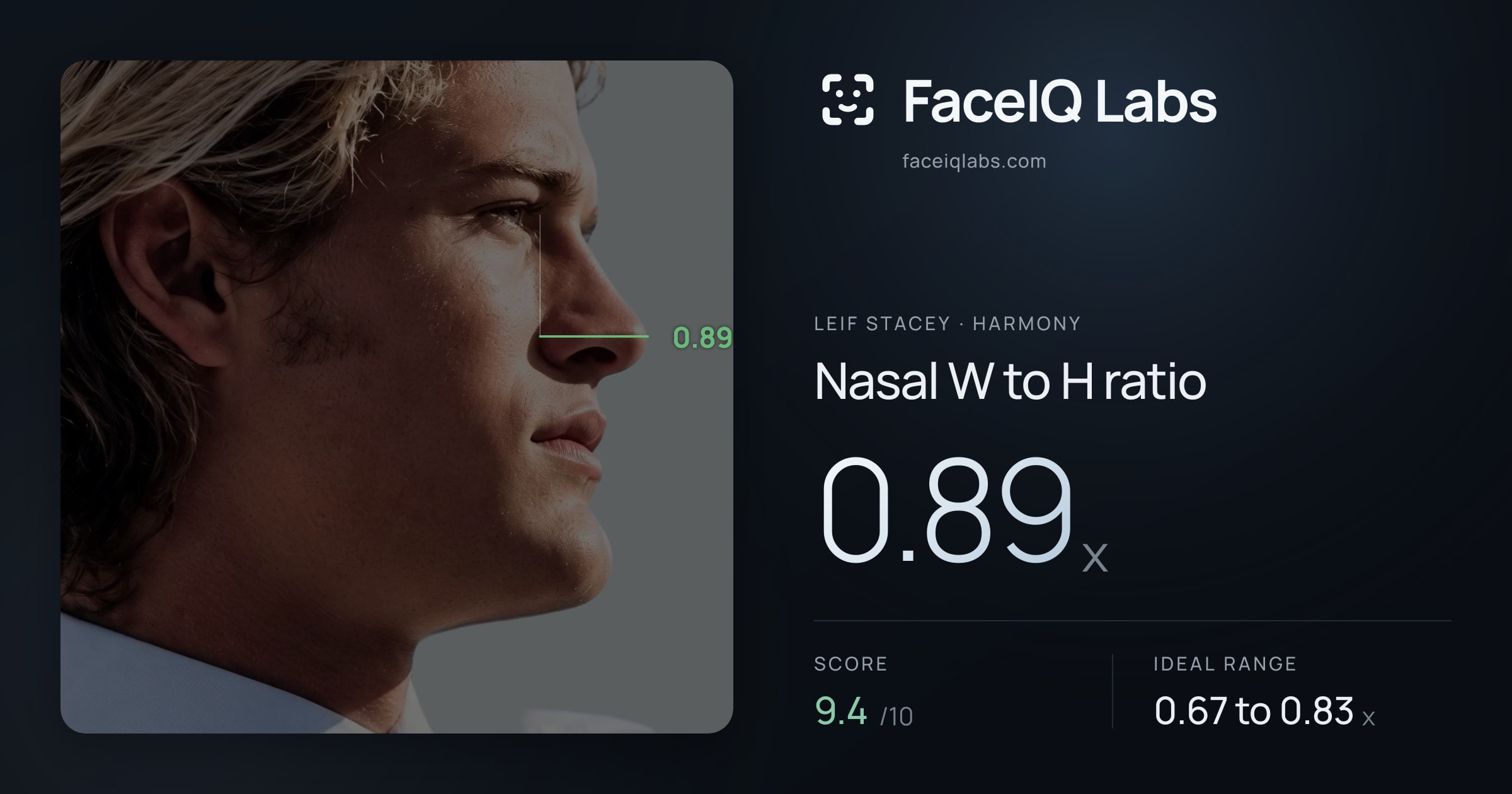 Leif Stacey Nasal W to H ratio: 0.89x, drawn on the photo
