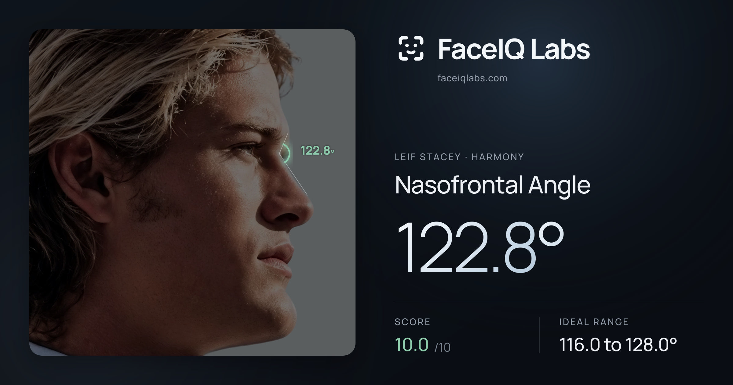 Leif Stacey Nasofrontal Angle: 122.8°, drawn on the photo