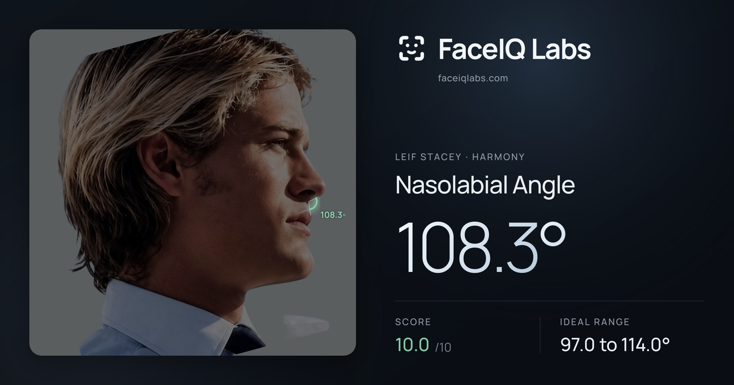 Leif Stacey Nasolabial Angle: 108.3°, drawn on the photo