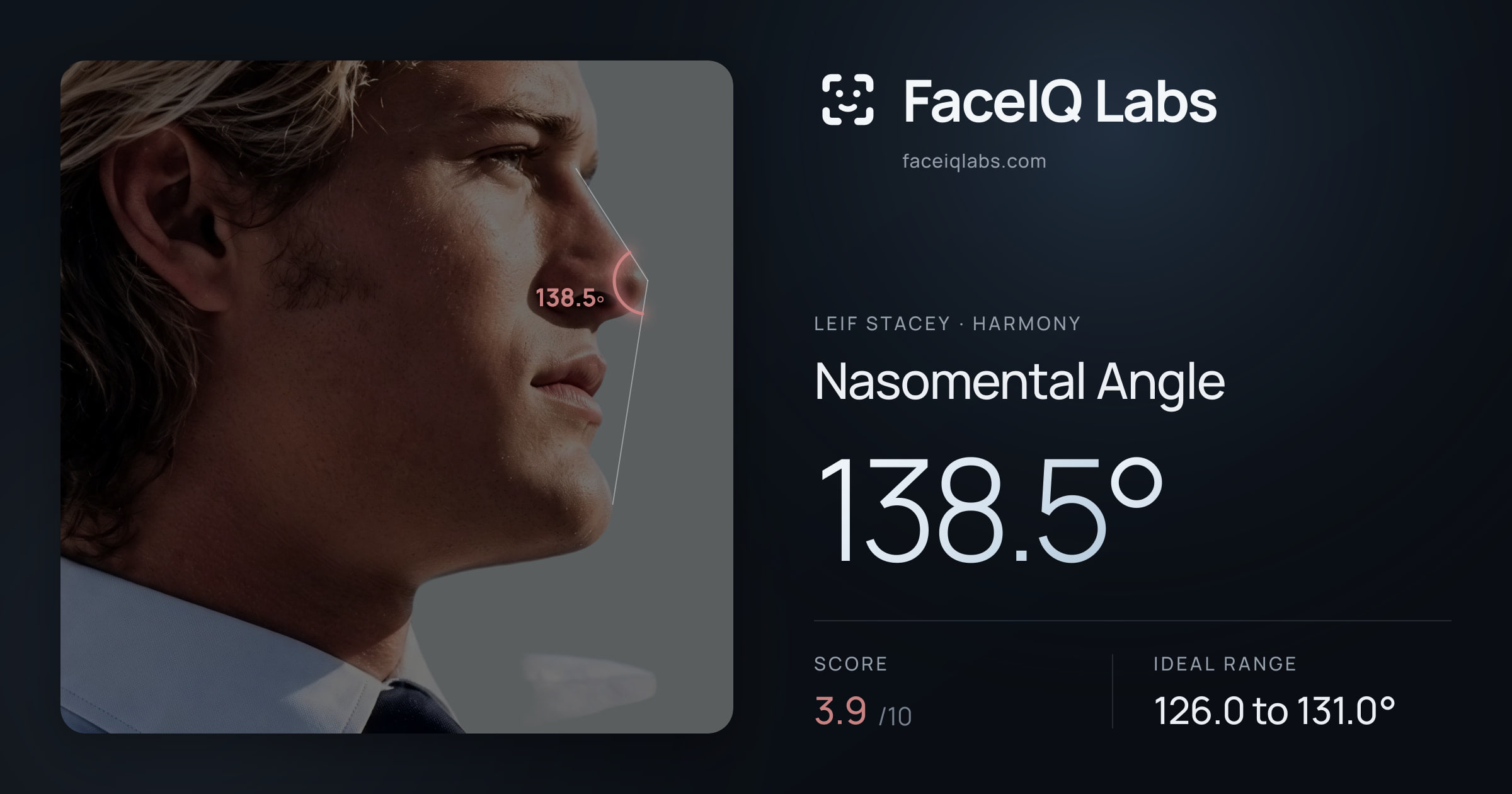 Leif Stacey Nasomental Angle: 138.5°, drawn on the photo