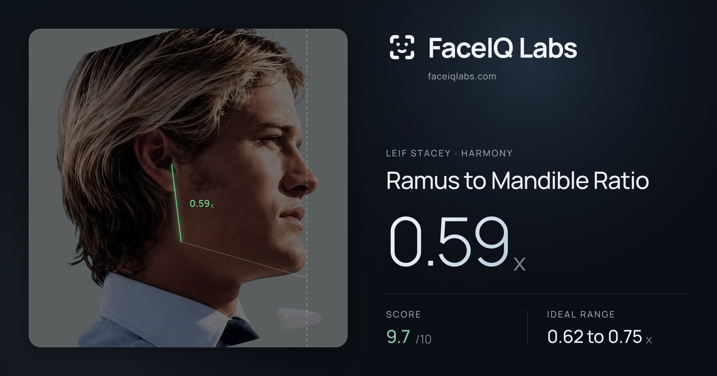 Leif Stacey Ramus to Mandible Ratio: 0.59x, drawn on the photo