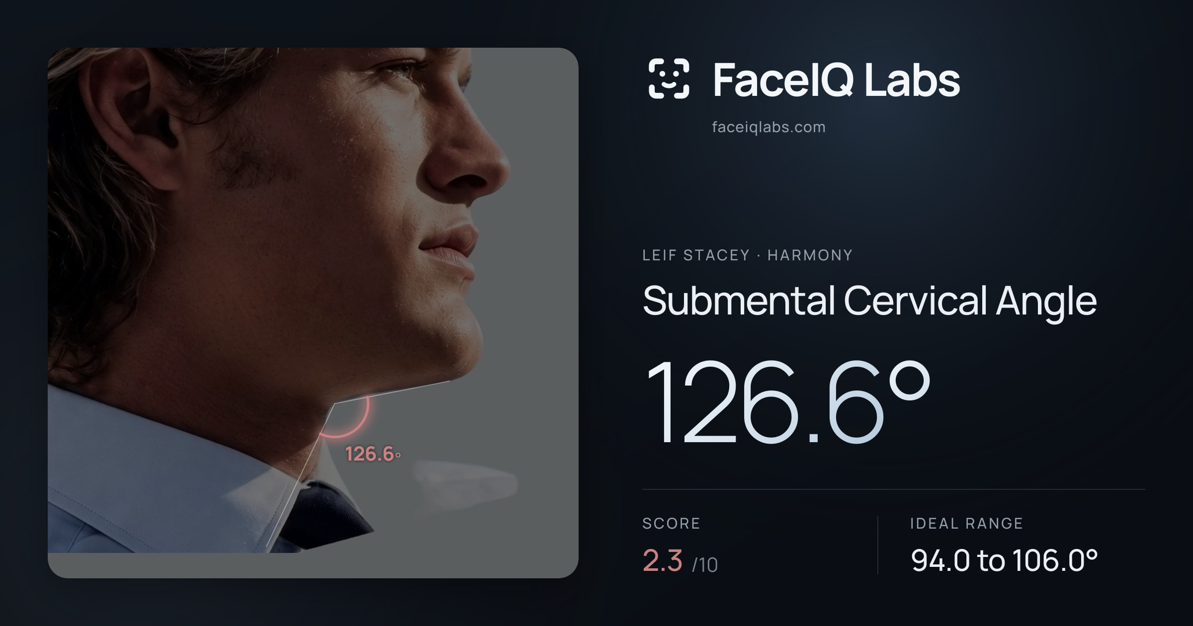 Leif Stacey Submental Cervical Angle: 126.6°, drawn on the photo