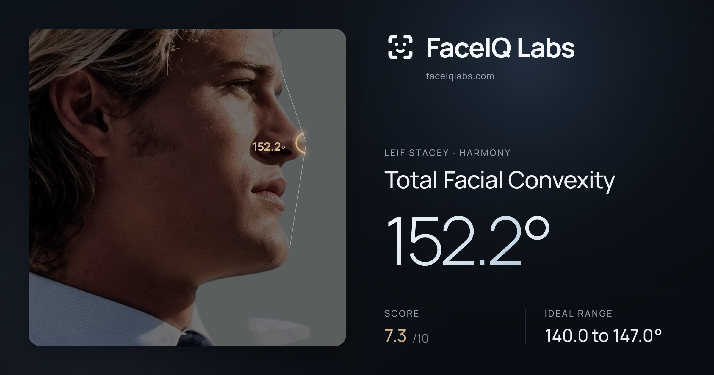 Leif Stacey Total Facial Convexity: 152.2°, drawn on the photo