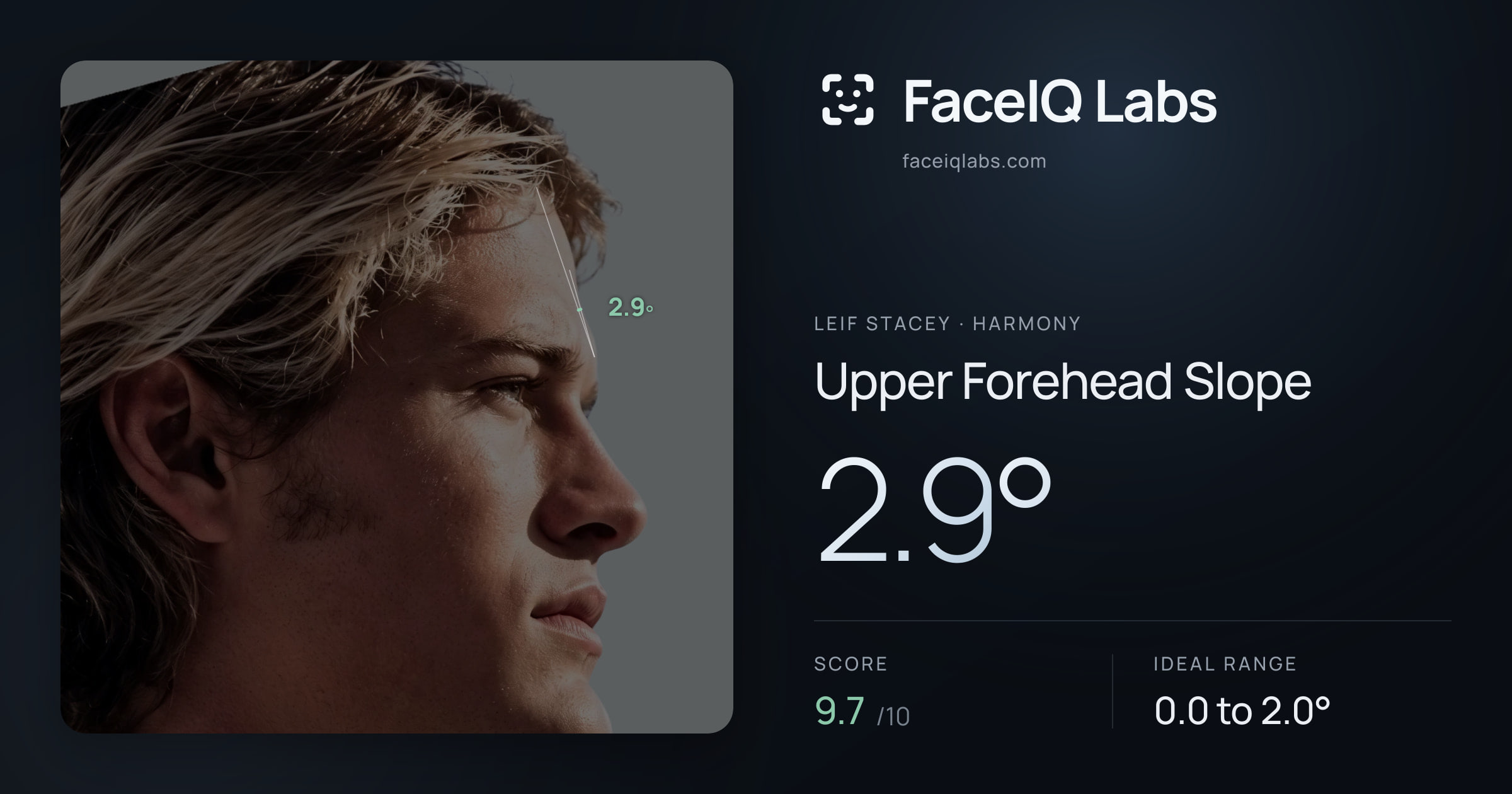 Leif Stacey Upper Forehead Slope: 2.9°, drawn on the photo