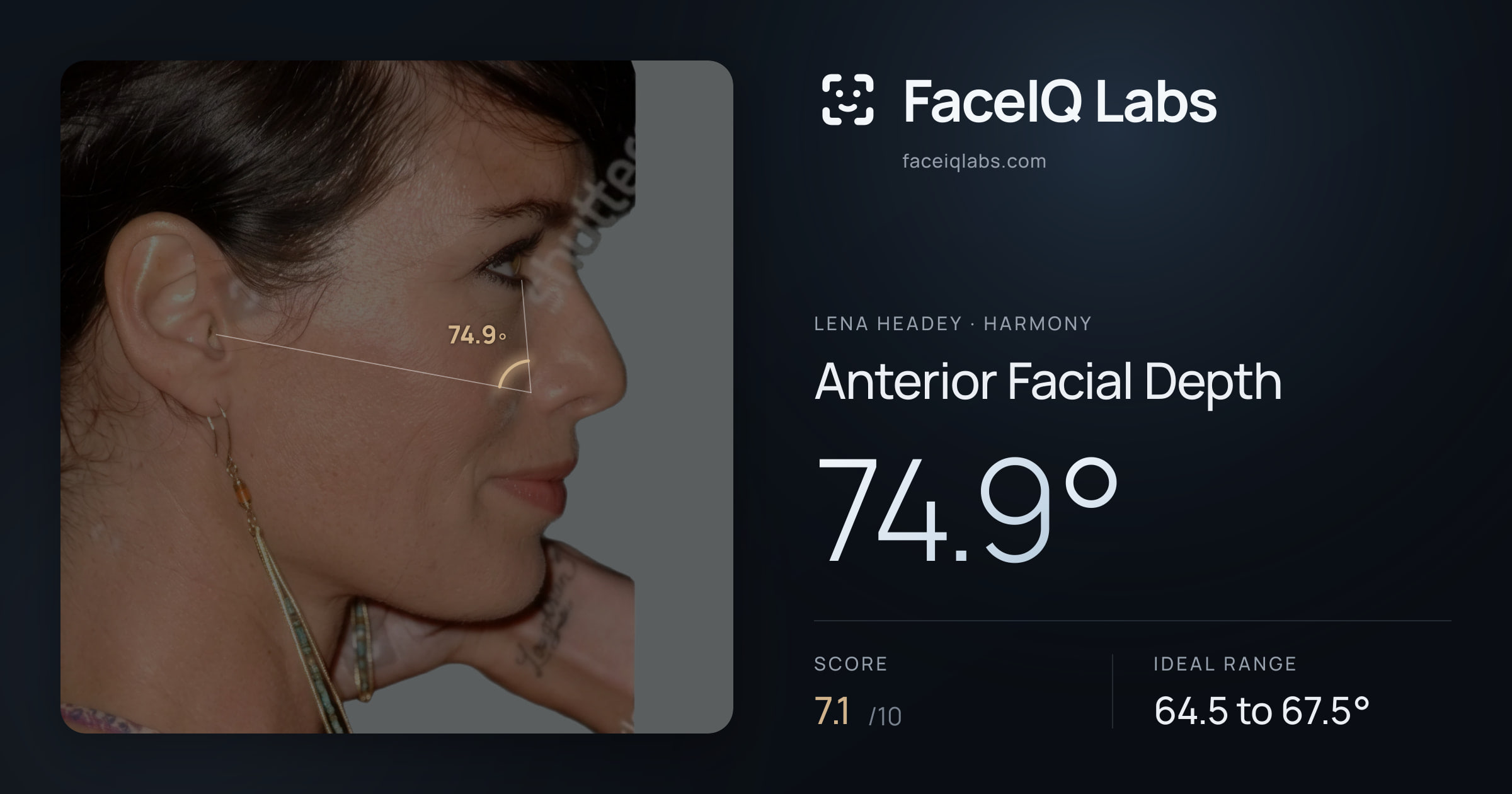 Lena Headey Anterior Facial Depth: 74.9°, drawn on the photo