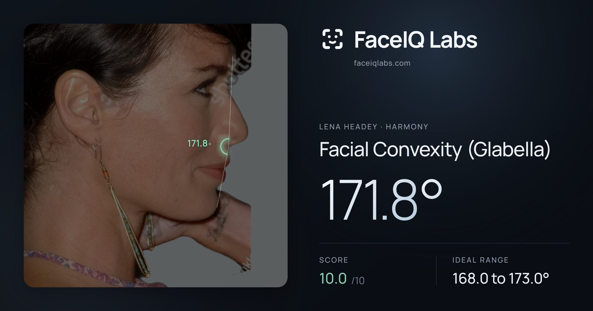 Lena Headey Facial Convexity (Glabella): 171.8°, drawn on the photo