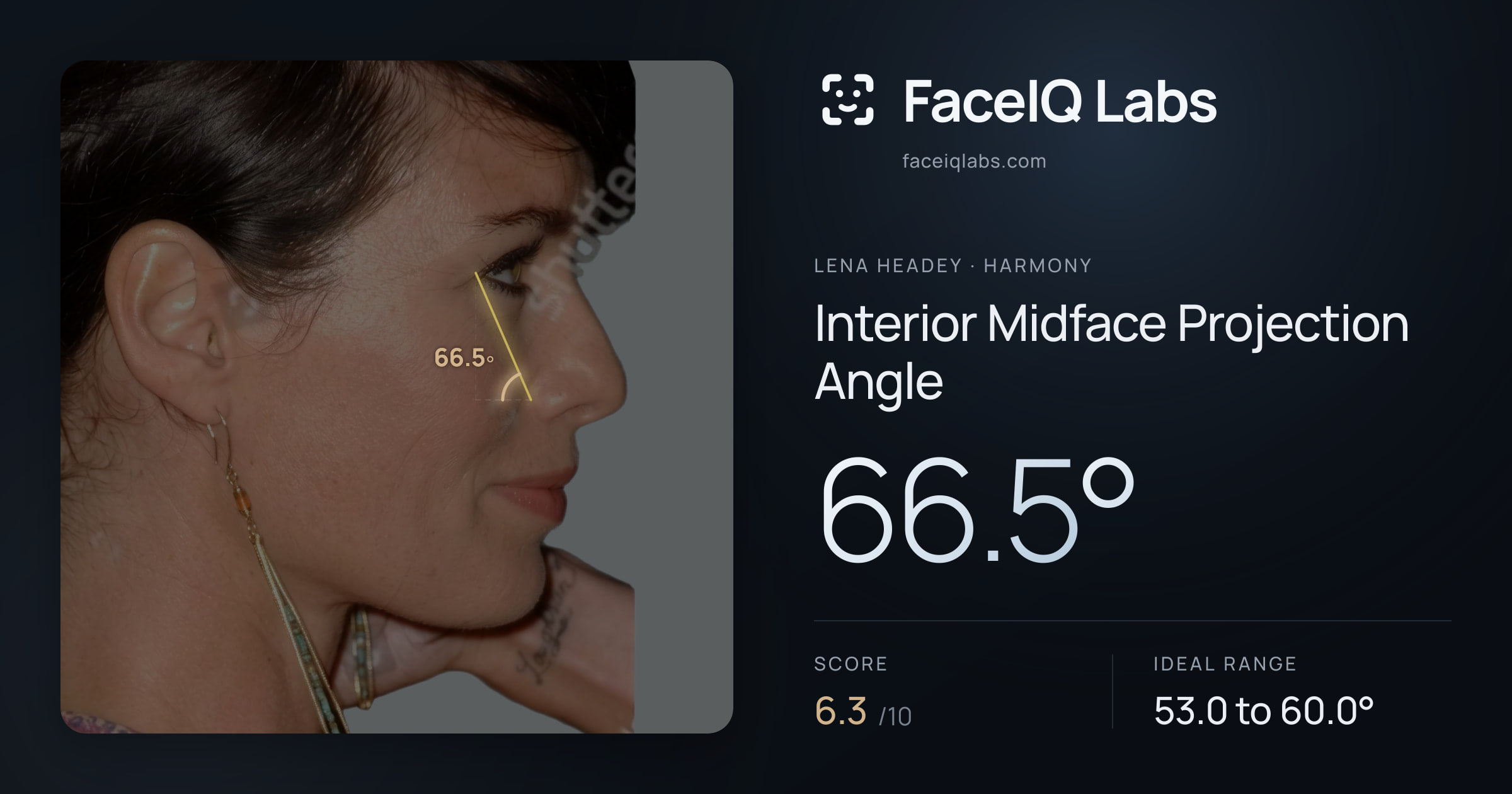 Lena Headey Interior Midface Projection Angle: 66.5°, drawn on the photo