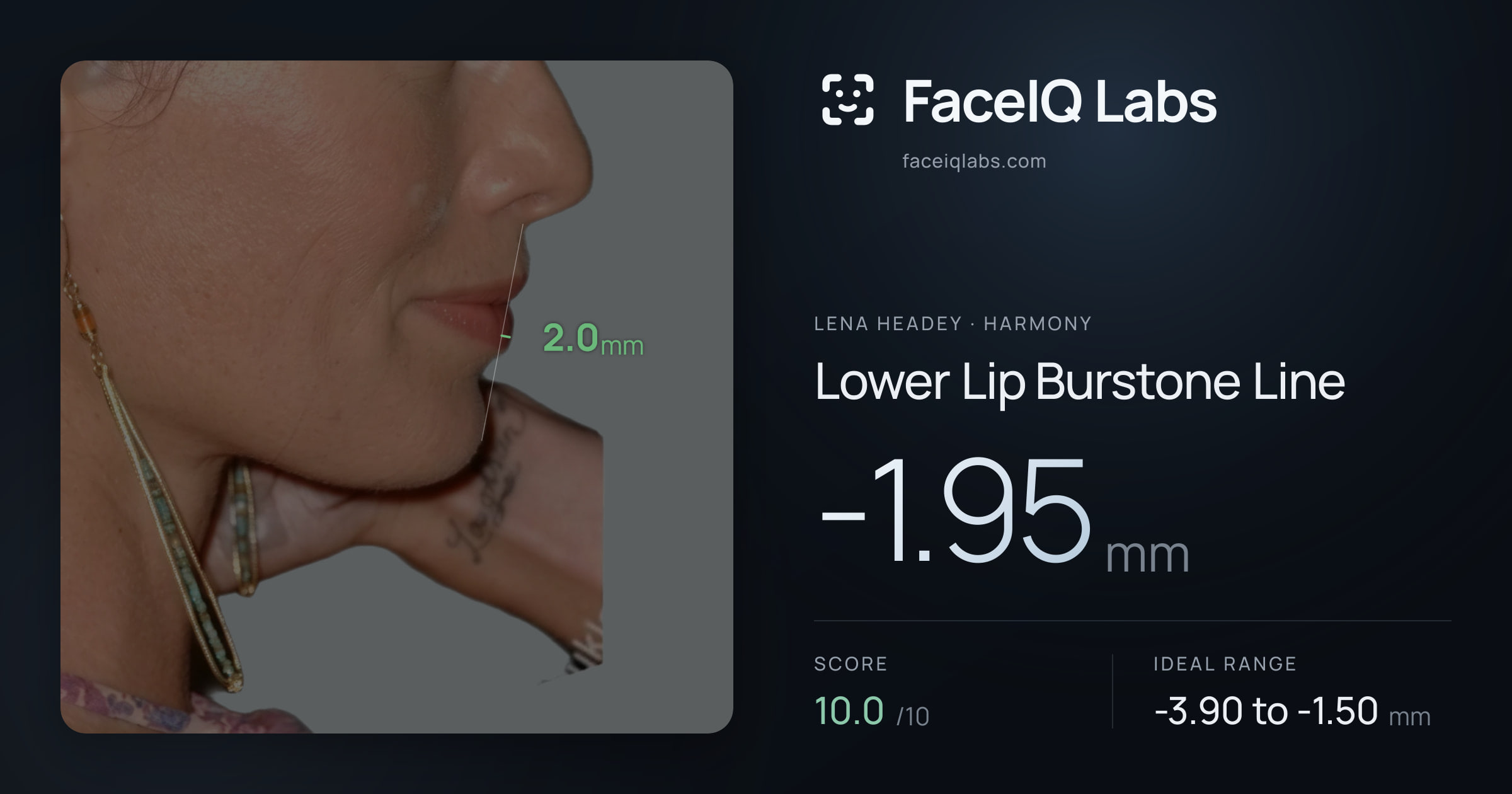 Lena Headey Lower Lip Burstone Line: -1.95mm, drawn on the photo