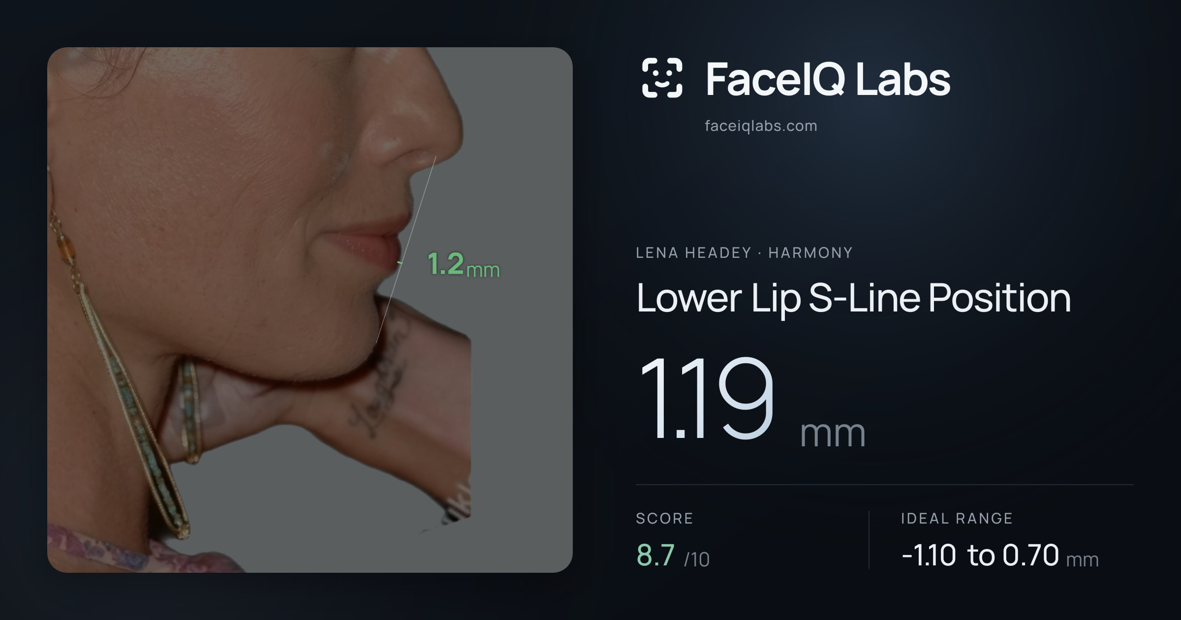 Lena Headey Lower Lip S-Line Position: 1.19mm, drawn on the photo
